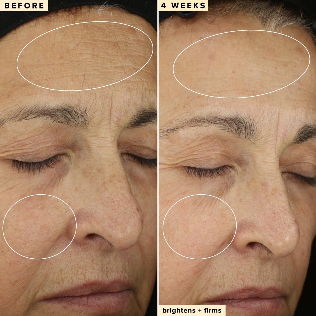 Farmacy 10% Vitamin C Serum for Face - Brightening Vitamin C Face Serum to Firm + Smooth Skin Texture - L Ascorbic Acid + Tangerine Peel Infused Skin Care to Hydrate and Even Skin Tone (30ml) - Medaid International