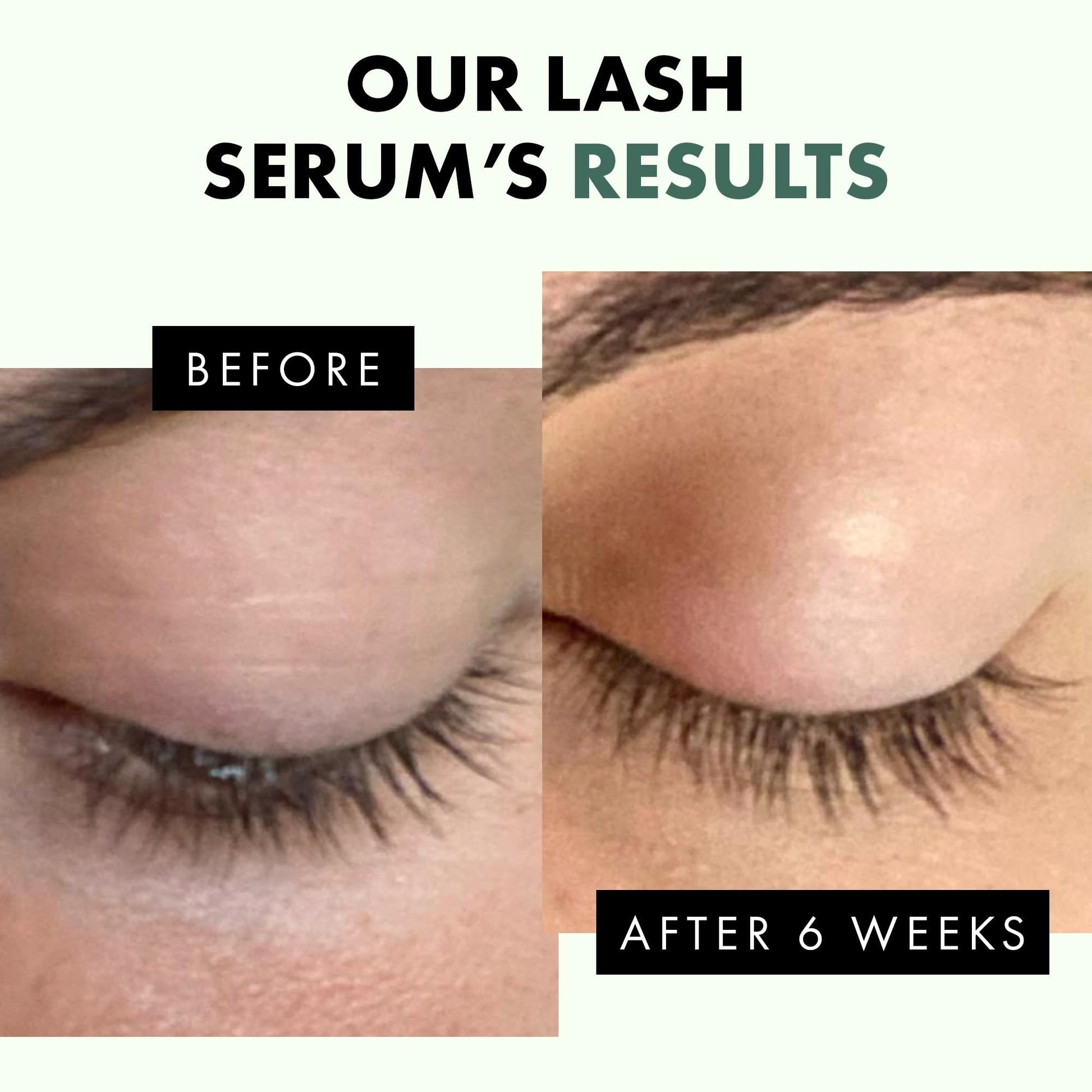 Eyelash Growth Serum - Lash Serum for Thicker-Looking Lashes and Brows - Eyelash to Lengthen, Strengthen and Add Shine to Hair, Nourishing and Moisturizing - Medaid International