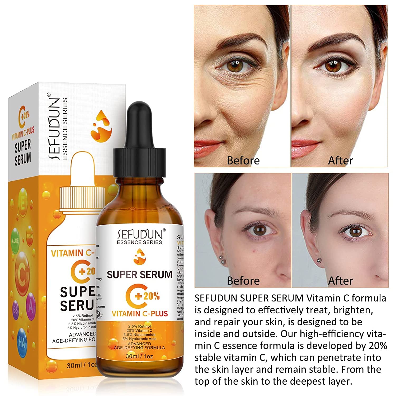 20% Vitamin C Serum for Face with Hyaluronic Acid 1 Fl Oz, Anti Aging Facial Serum for Women & Men, Antioxidant, Boost Skin Collagen, Fades Dark Spot, Hydrate & Plump Skin, Anti Aging & Wrinkle - Medaid International