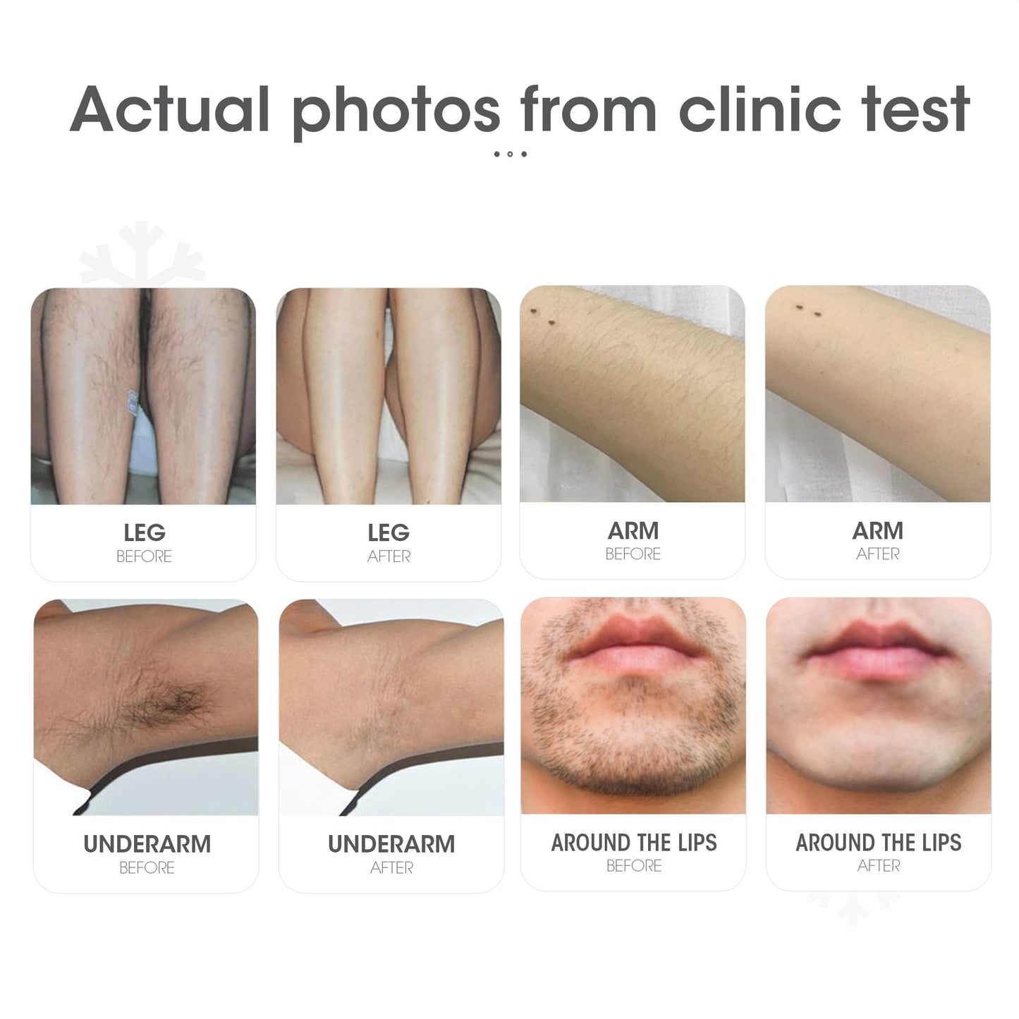 DEESS IPL Laser Hair Removal Device for Women & Men, GP591 3 in 1 Fastest Flashes ICE-Cooling Permanent Hair Remover, Safe & Painless, Long-lasting Reduction of Body & Face Hair Regrowth, Home Use - Medaid International