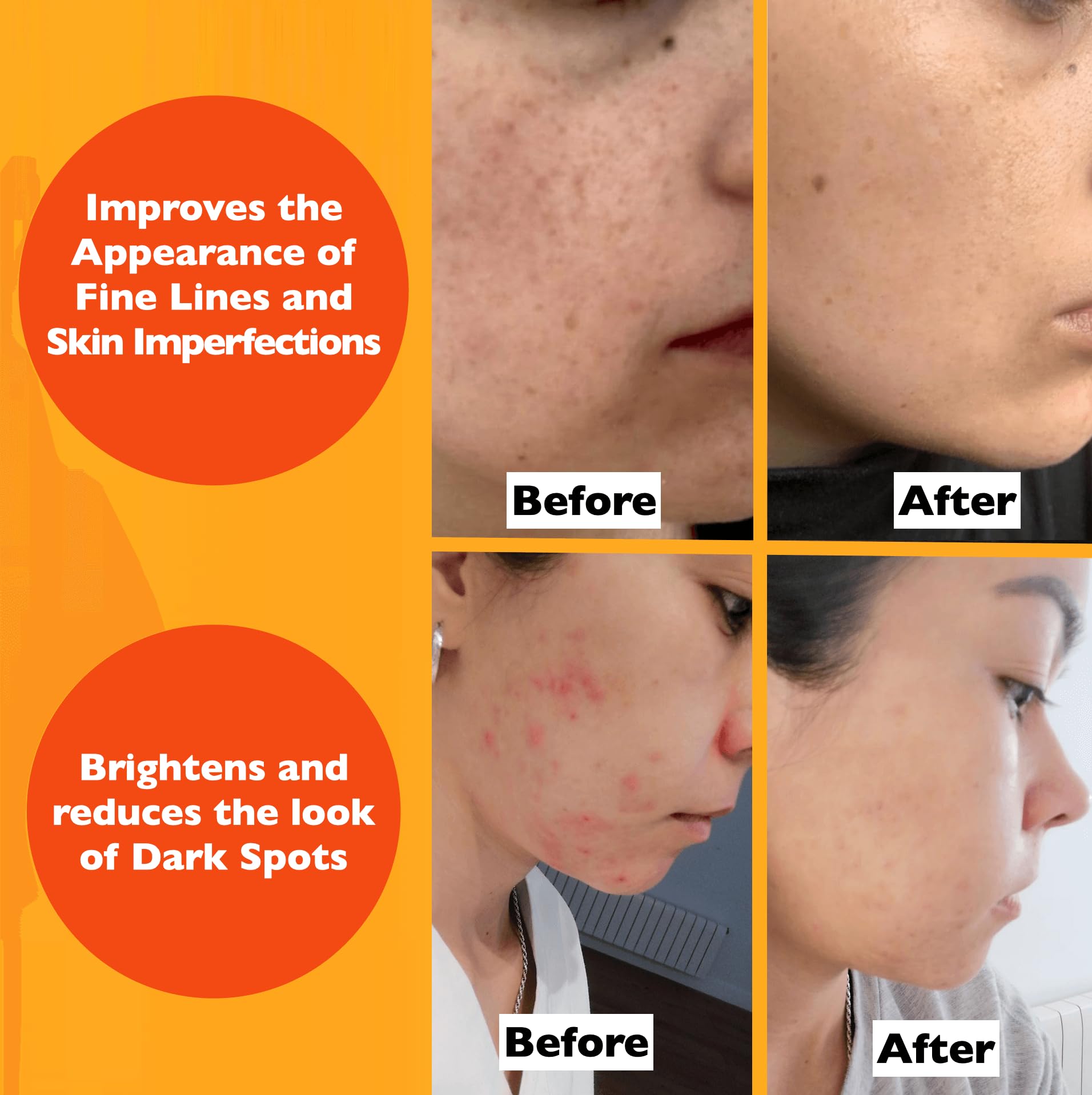 Vitamin C Serum For Face – Anti-Aging Facial Serum with Vitamin C, Hyaluronic Acid, Niacinamide, B5 & Vit E. Brightening Facial Essence for Dark Spots, Fine Lines, Wrinkles & Glowing Skin, 2 Fl Oz - Medaid International