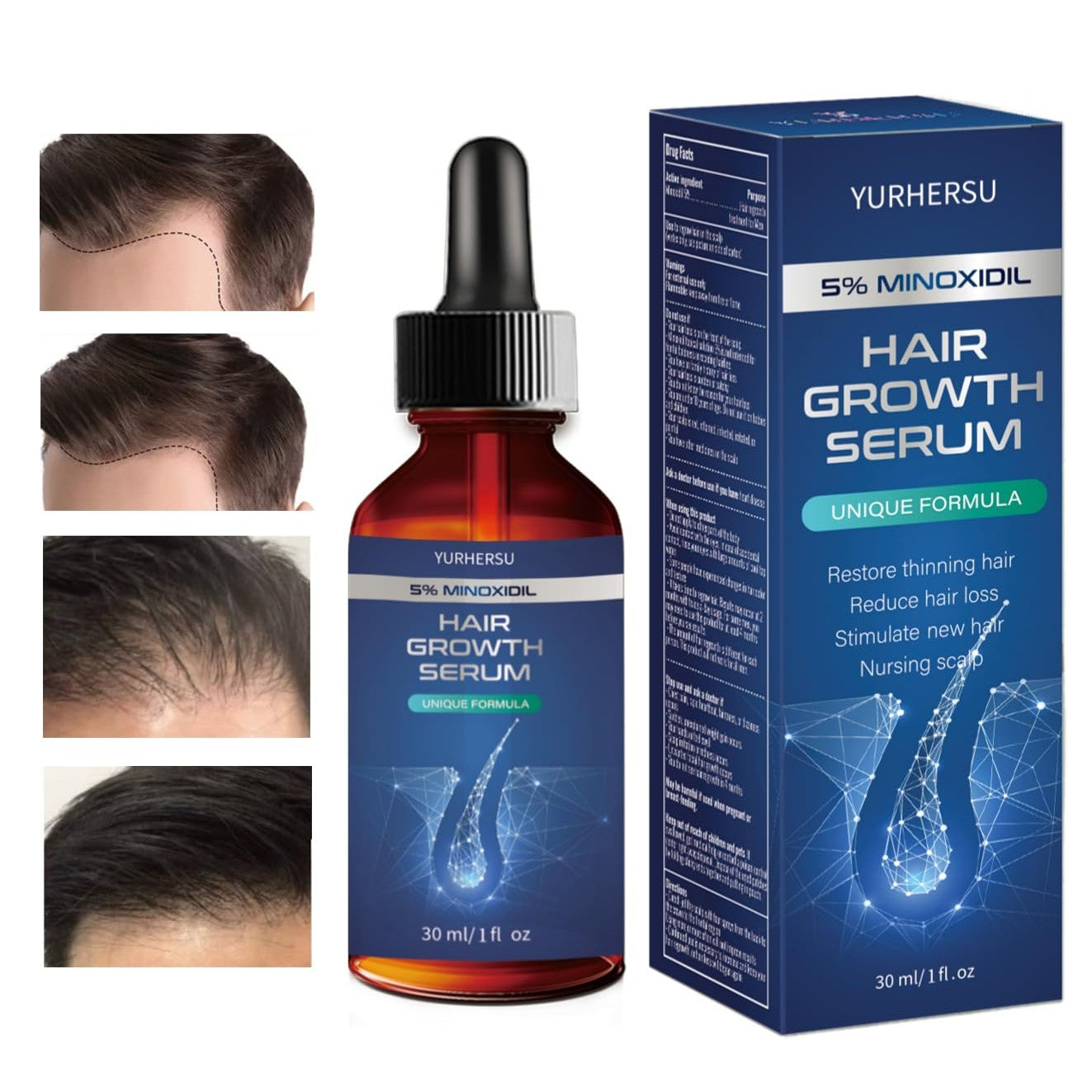 Hair Growth Serum, 5% Minoxidil, With Biotin & Glycerin, for Men's Beard & Women's Hair Regrowth, Anti Hair Loss Treatment, Make Hair Stronger Thicker Longer, 1 fl oz (30 ml) - Medaid International
