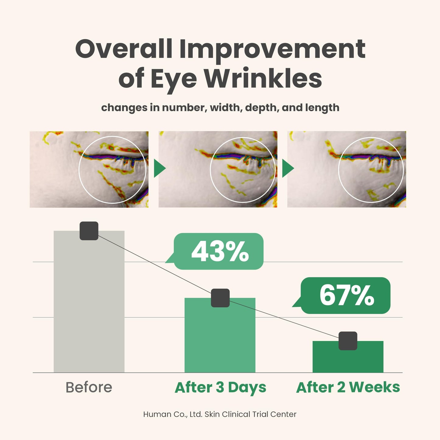 AXIS-Y Vegan Collagen Eye Serum - K Beauty Triple Hyaluronic Acid & Peptide Collagen Serum Improve Skin Elasticity, Reduce Fine Lines & Dark Circles - Vegan Korean Skin Care Eye Cream - 0.33 fl. oz. - Medaid International