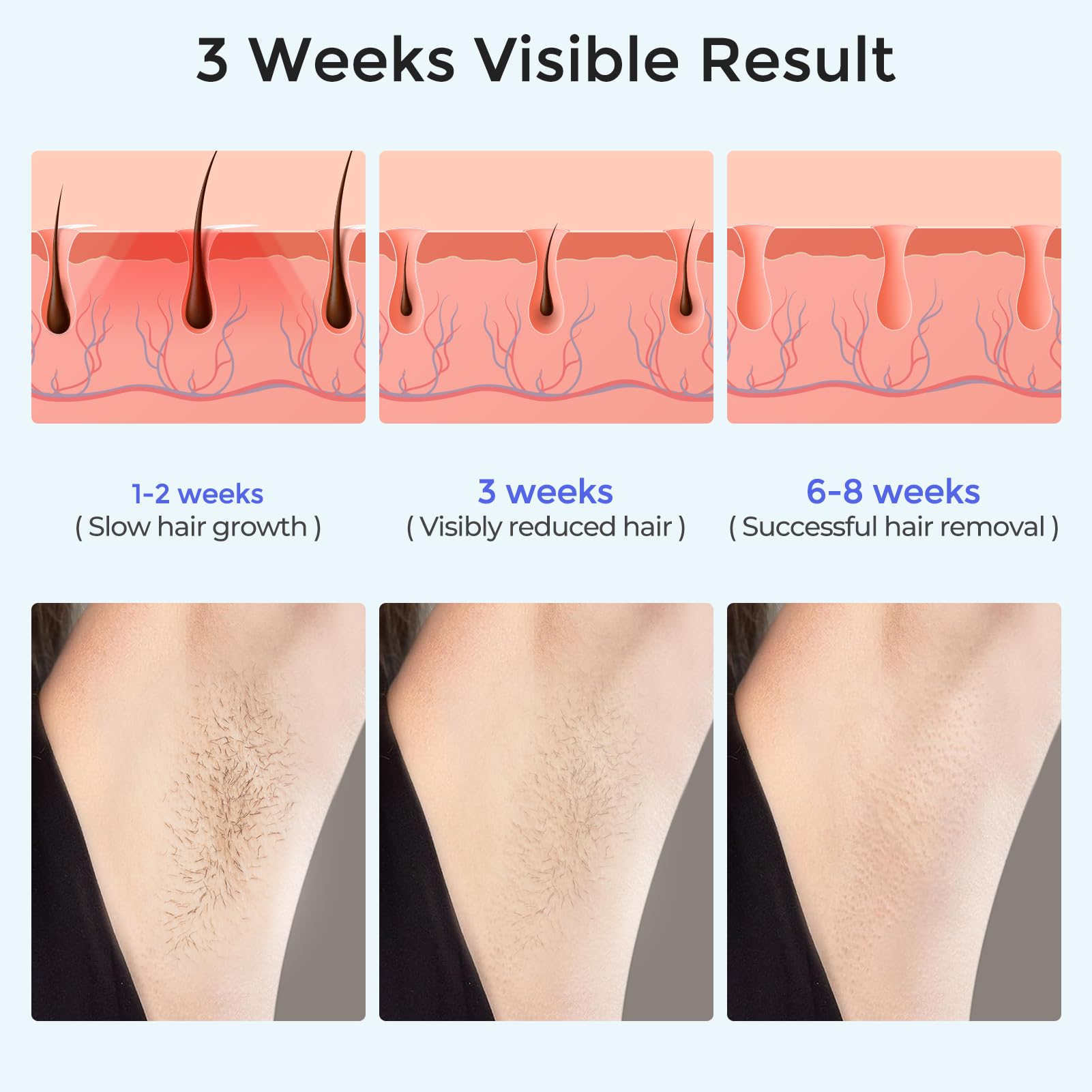 Laser Hair Removal Women and Men, Sapphire Ice-Cooling Contact IPL Hair Removal, Painless and Permanent, Alternative to Salon, Hair Removal Device for Armpits, Legs, Bikini, Face - Medaid International