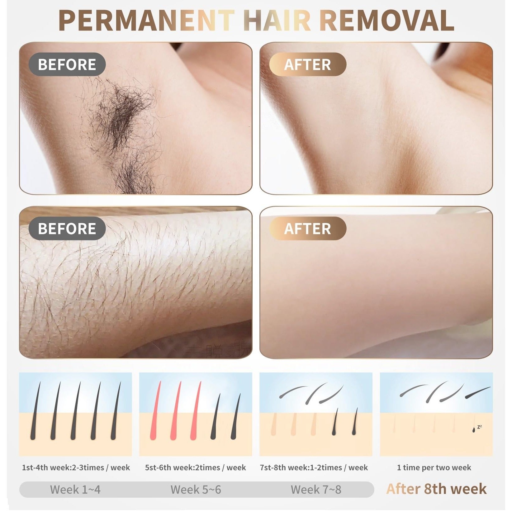 Home Use Beauty Device IPL Laser Hair Removal for Women and Men,999999 Flashes at-Home Laser Hair Removal Device - Medaid International