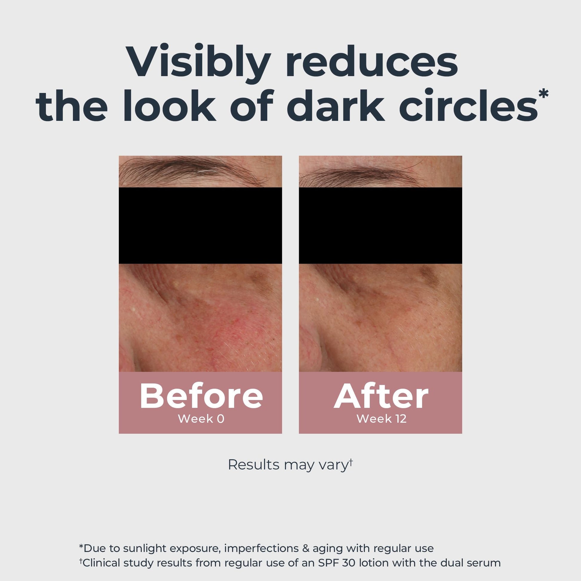 Eucerin Radiant Tone Eye Cream Dark Circle Corrector, Eye Brightening Cream with Thiamidol and Hyaluronic Acid, Helps Reduce the Look of Eye Puffiness, 0.5 Oz Tube - Medaid International