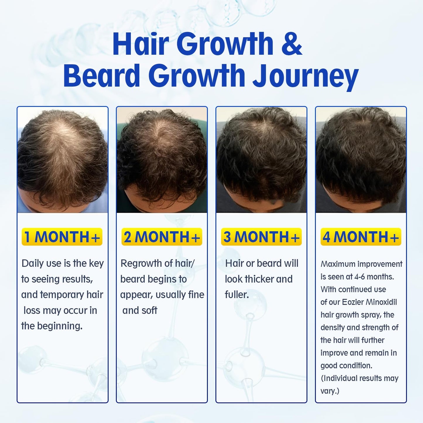 5% Minoxidil with Biotin, Hair Loss Treatments for Women Men Hair Regrowth Treatment, Minoxidil Spray Hair and Beard Mustached Growth Serum Oil, Improves Appearance of Thinning Hair,4 FL OZ/120mL - Medaid International