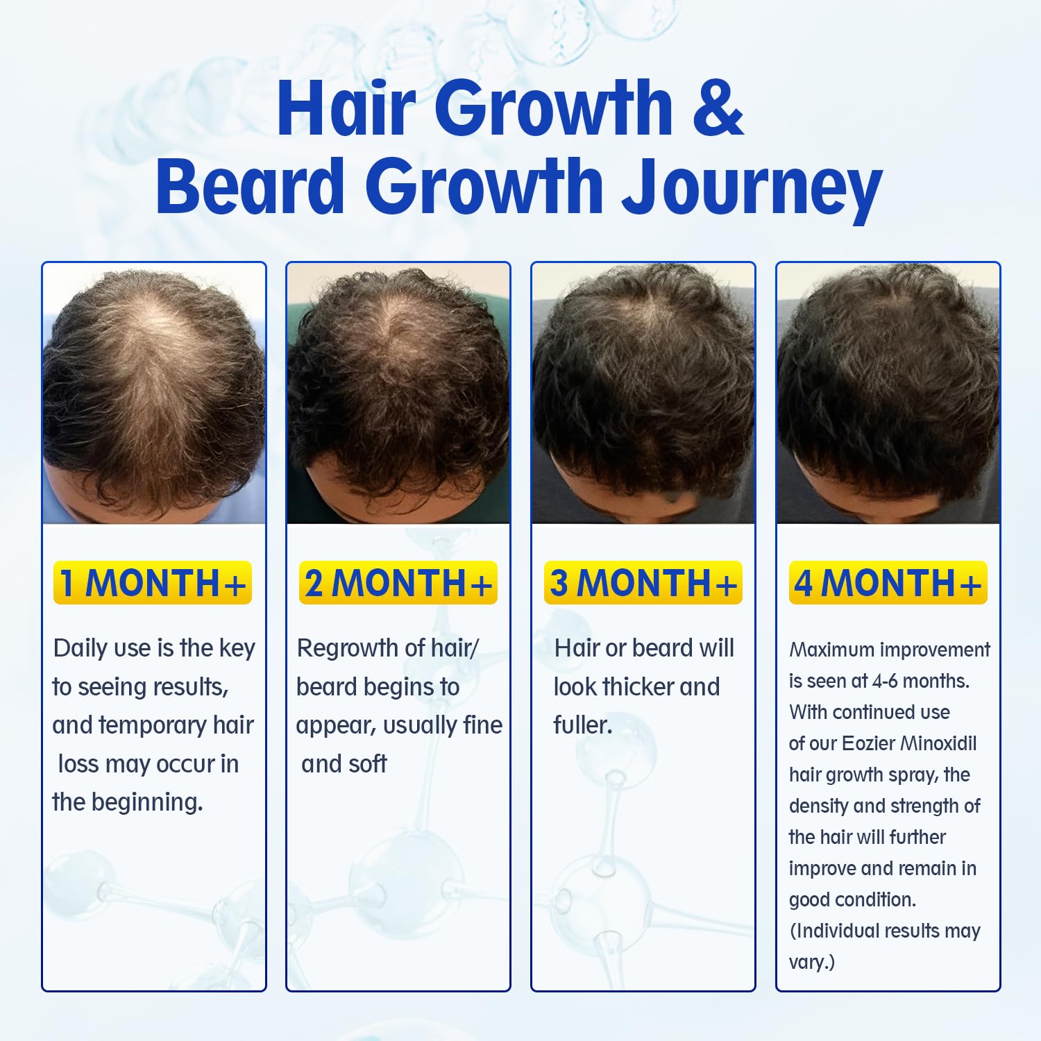 5% Minoxidil with Biotin, Hair Loss Treatments for Women Men Hair Regrowth Treatment, Minoxidil Spray Hair and Beard Mustached Growth Serum Oil, Improves Appearance of Thinning Hair,4 FL OZ/120mL - Medaid International