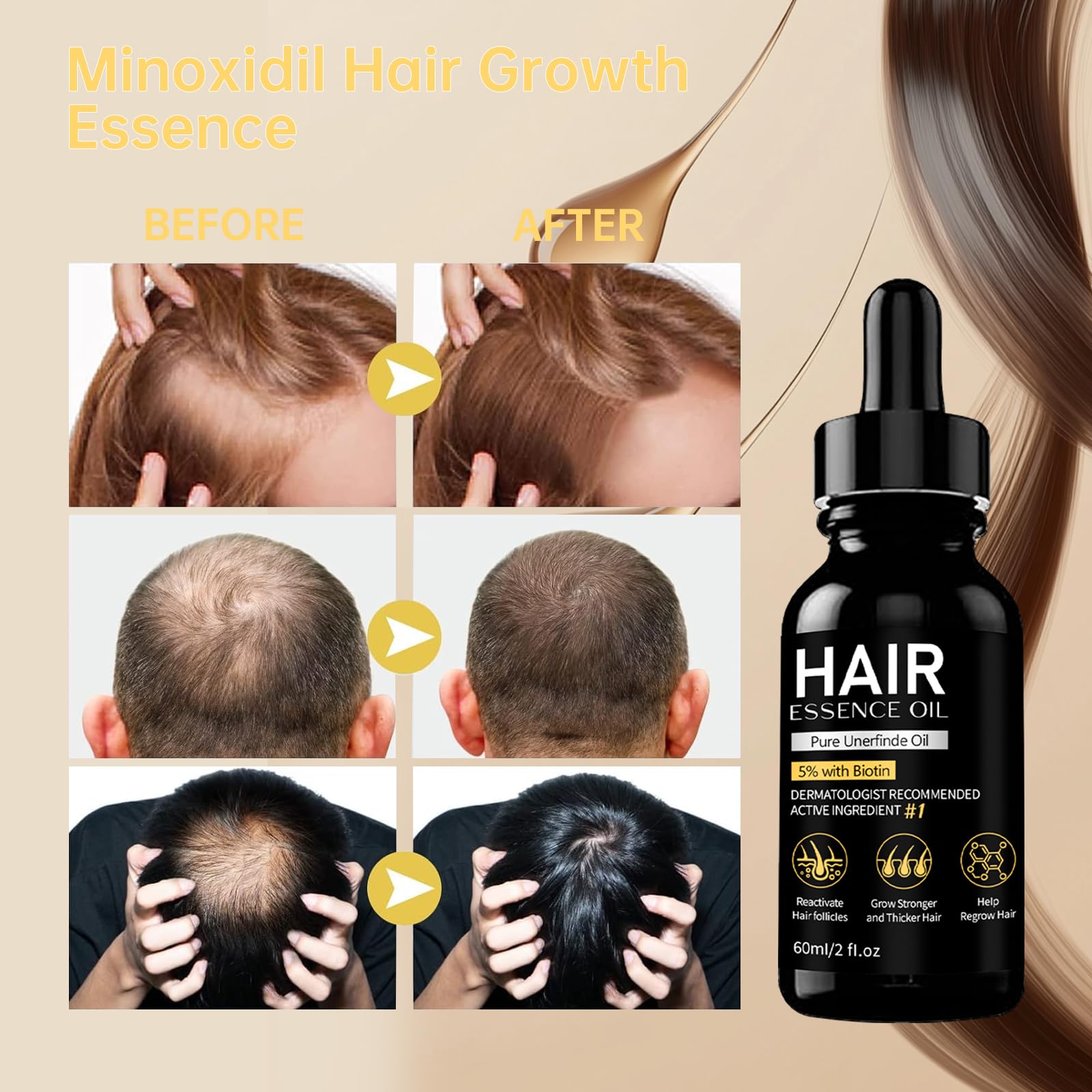 5% Minoxidil Hair Growth Serum, Natural Biotin Hair Oil for Men and Women, 2 fl oz - Medaid International