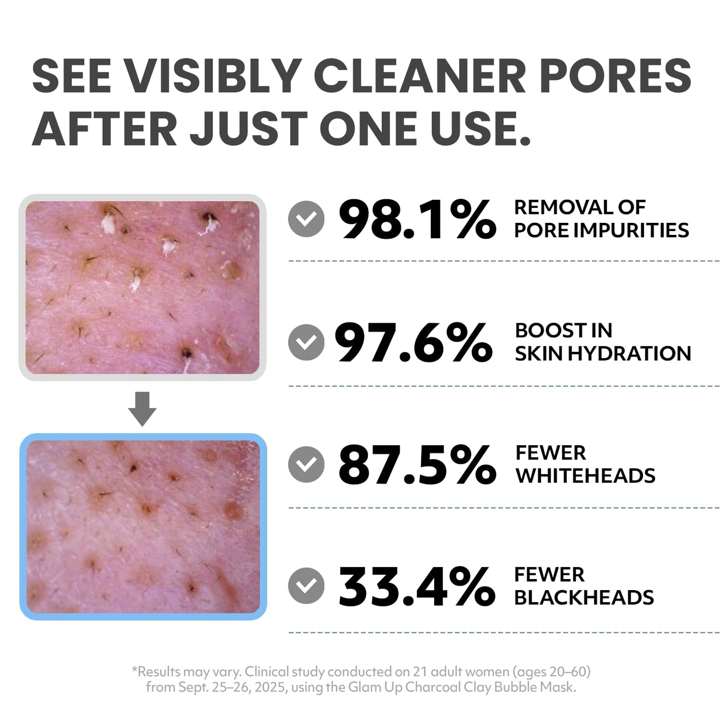 GLAM UP Clean Bubbling Carbonated Clay Mask for Face Purifying- Blackhead Remover, Peel Off, Pore Clearing, Deep Cleansing, Detoxing Bubble Clay Mask, Vegan 135ml (4.56 Fl Oz) - Medaid International