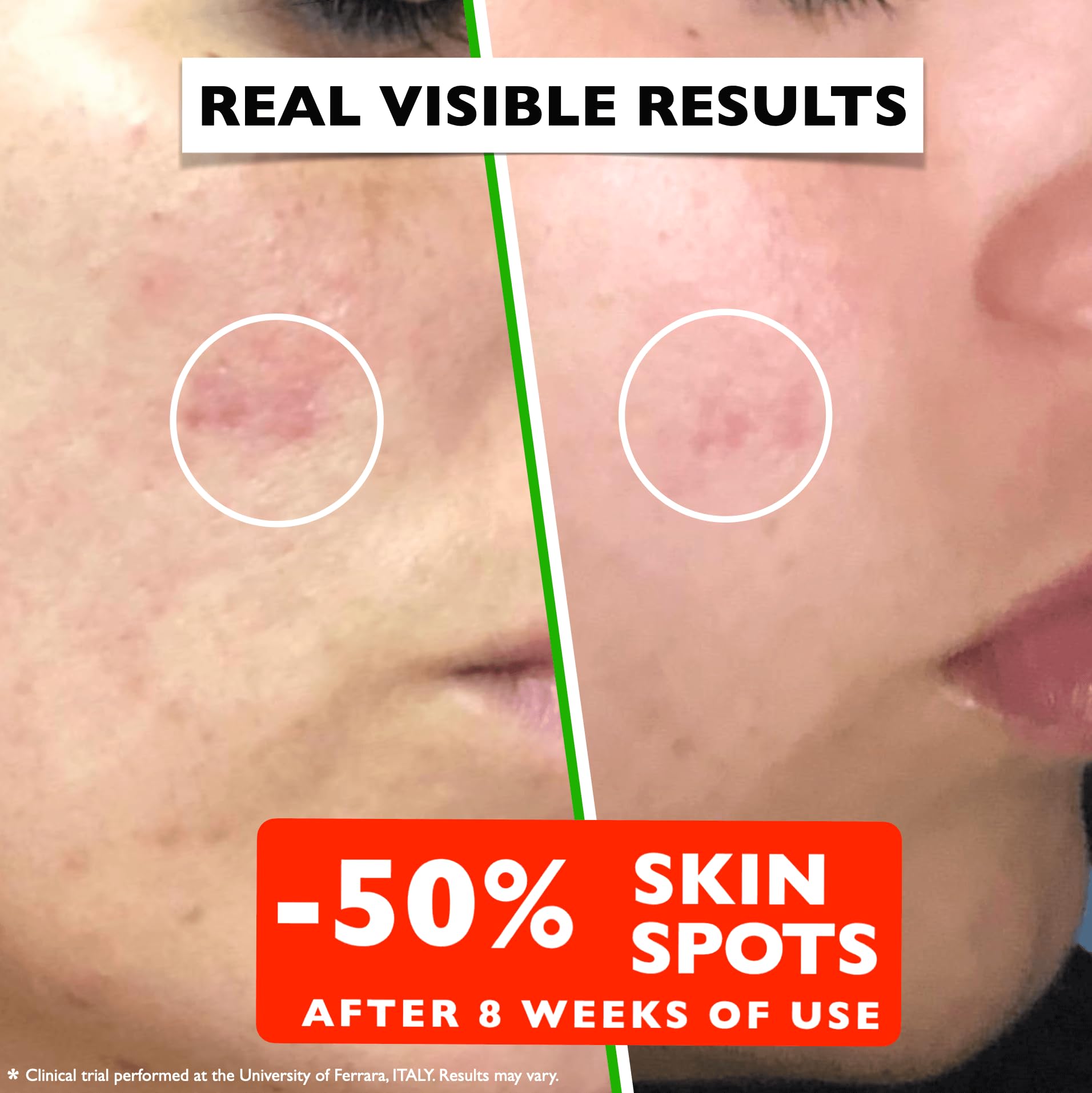 Vitamin C Serum For Face – Anti-Aging Facial Serum with Vitamin C, Hyaluronic Acid, Niacinamide, B5 & Vit E. Brightening Facial Essence for Dark Spots, Fine Lines, Wrinkles & Glowing Skin, 2 Fl Oz - Medaid International