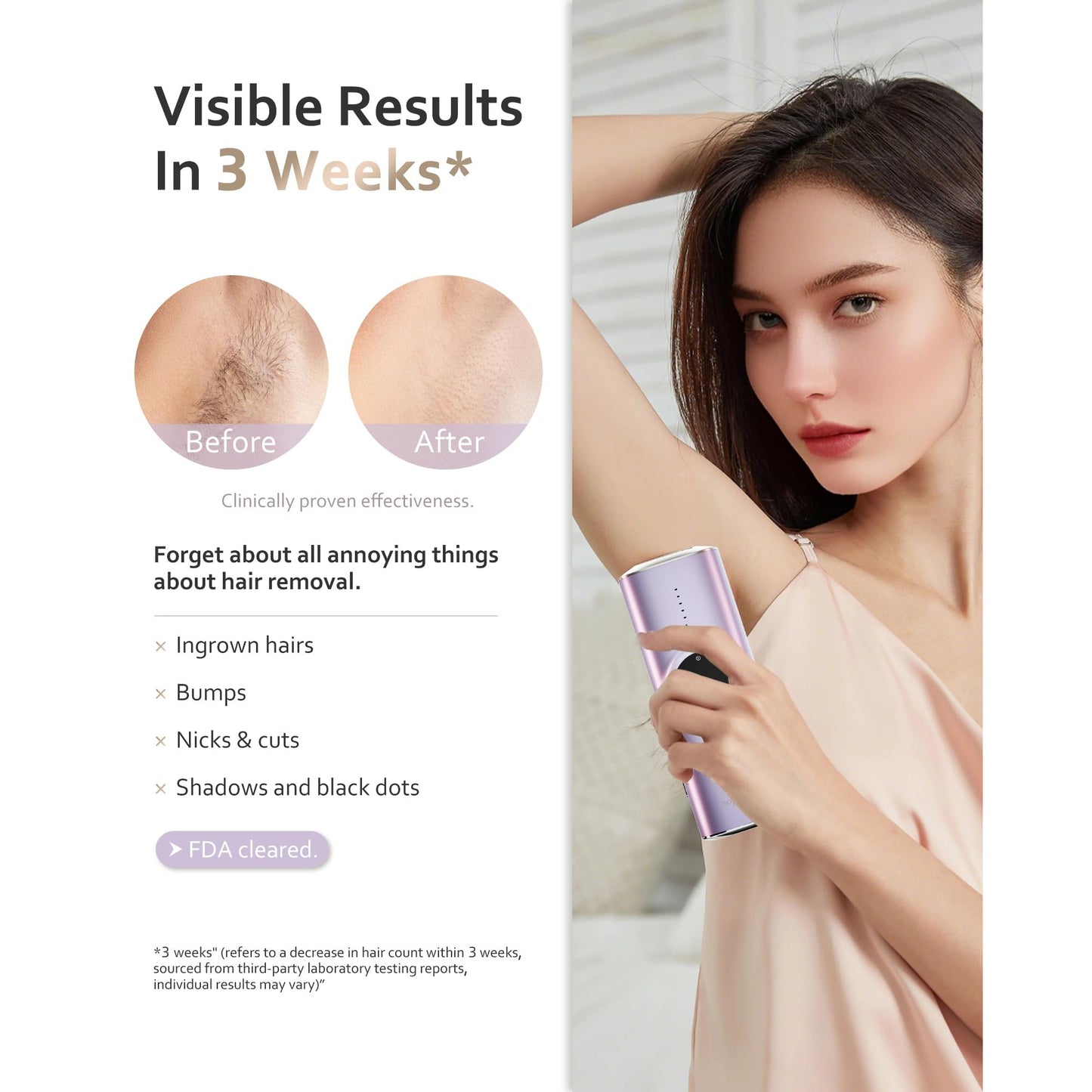 BeautyGlow Laser Hair Removal Device for Women & Men, At Home IPL Hair Remover with Ice Cooling Technology for Face & Body, Painless & Long-Lasting Results - Medaid International