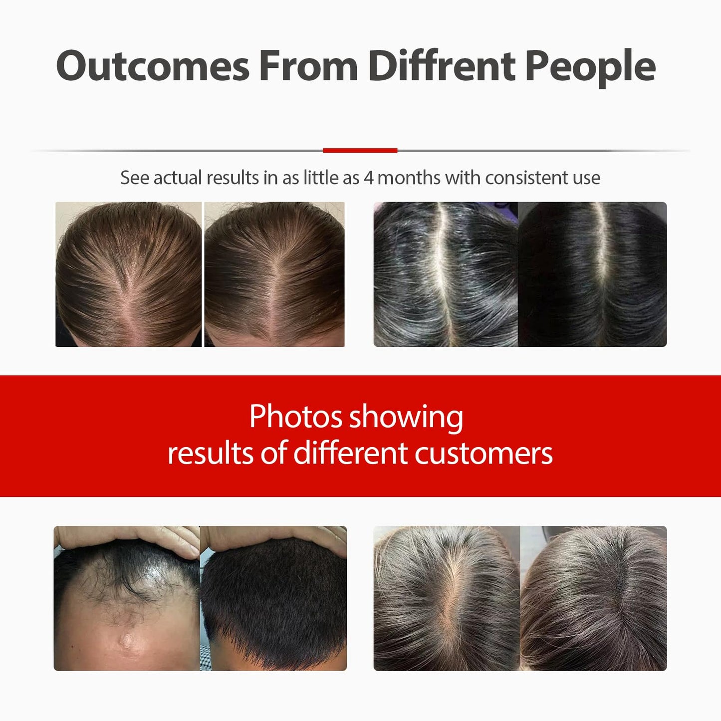 2026 Upgrade Laser Cap, Red Light Therapy for Hair Growth - Medaid International