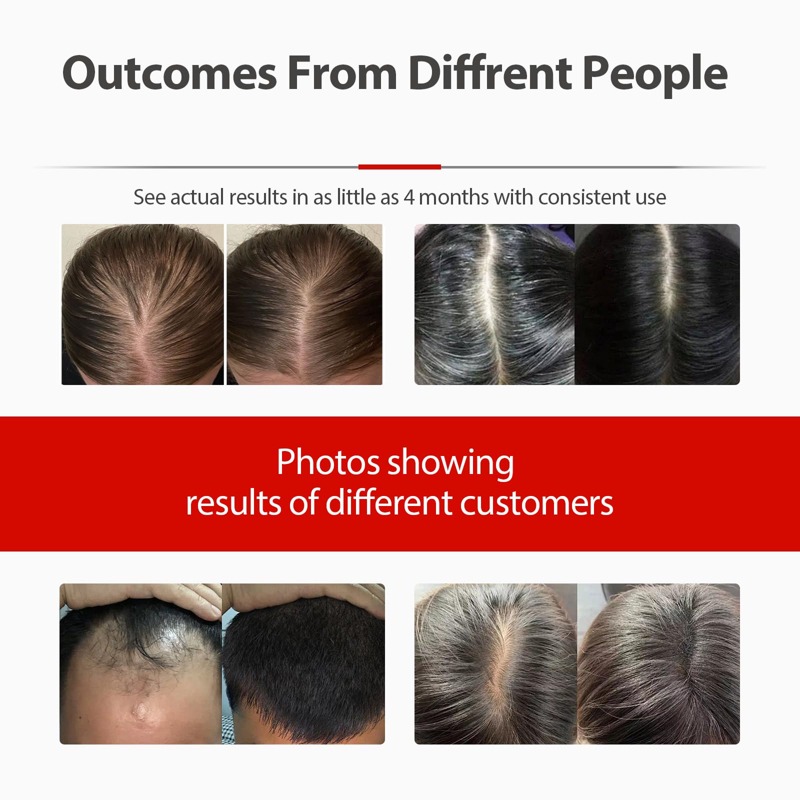 2026 Upgrade Laser Cap, Red Light Therapy for Hair Growth - Medaid International