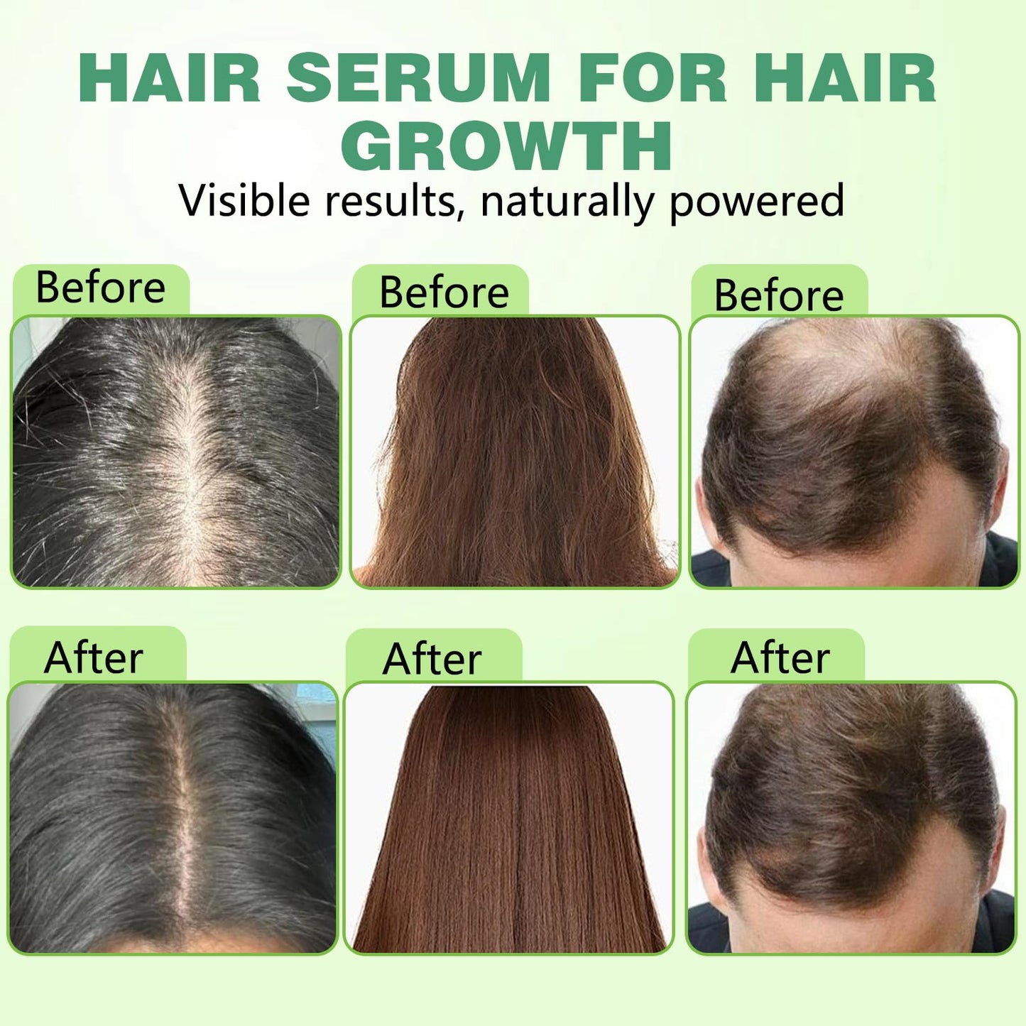 Hair Regrowth System, Advanced Hair Growth Treatment with Ginseng, Eclipta Prostrata, Peppermint Oil & Ginger Root,Hair Serum for Hair Growth,Hair Thickening Solution - Medaid International