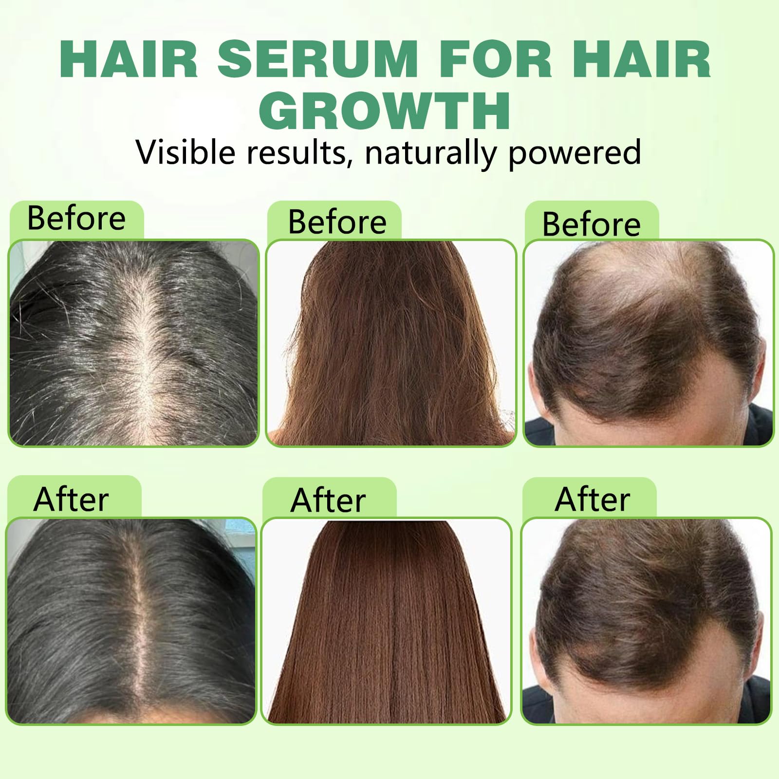 Hair Regrowth System, Advanced Hair Growth Treatment with Ginseng, Eclipta Prostrata, Peppermint Oil & Ginger Root,Hair Serum for Hair Growth,Hair Thickening Solution - Medaid International