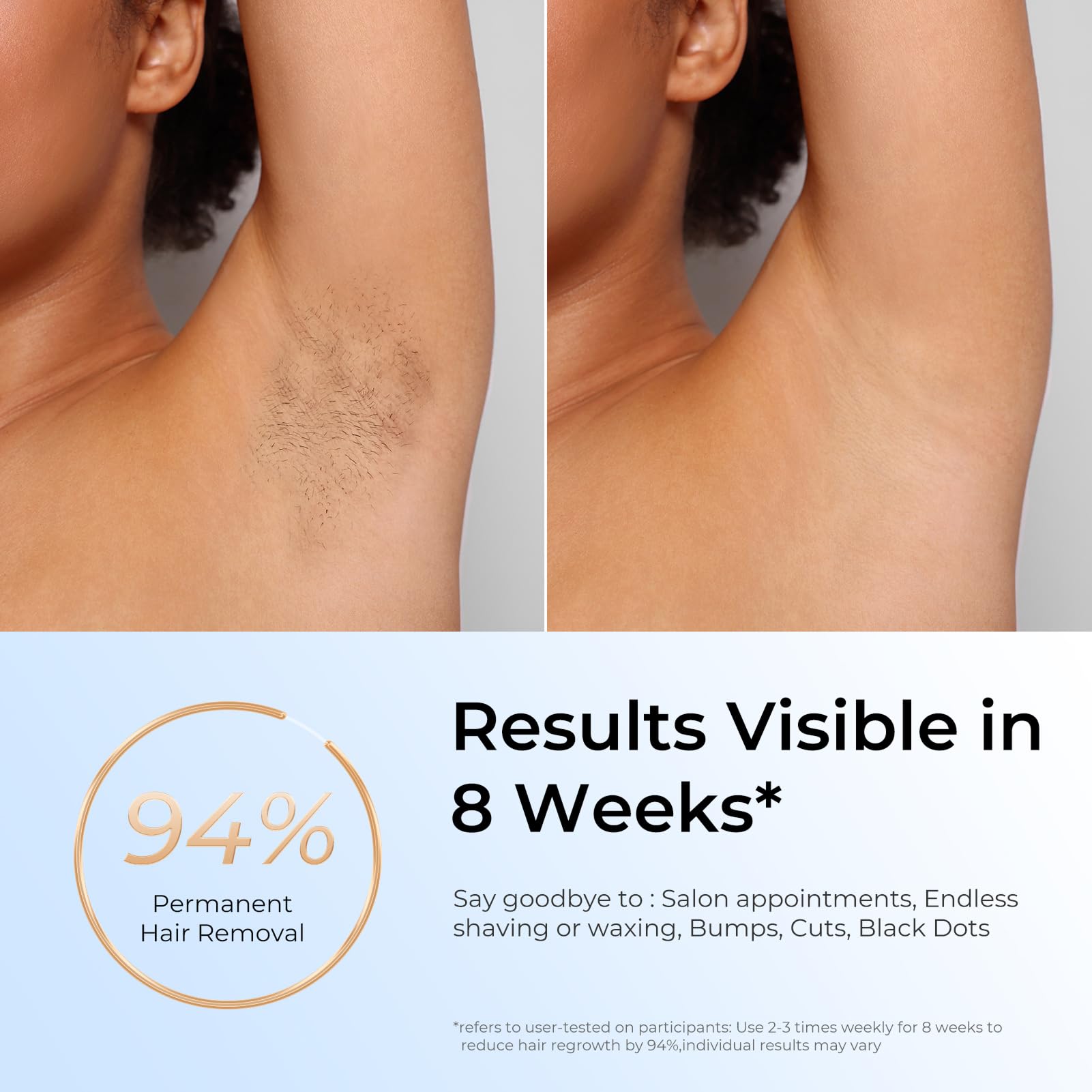 Finequin Laser Hair Removal, IPL Laser Hair Removal for Women and Men Permanent, Hair Removal Device with 3.0 IPL Red Light Wave, Home Laser Hair Removal Device for Facial Legs Armpits Bikini Body Use - Medaid International