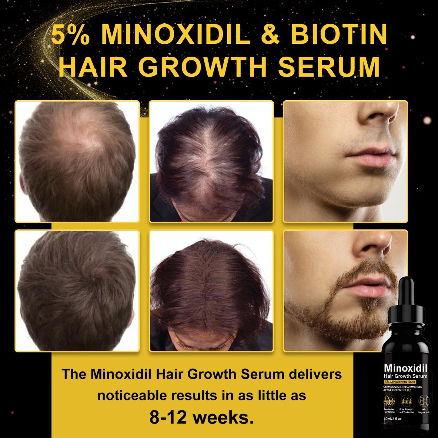 5% Minoxidil Hair Growth Serum, Topical Minoxidil for Men Beard Growth, Hair Regrowth for WomenTreatment for Scalp Hair Loss and Thinning, With Biotin - Medaid International