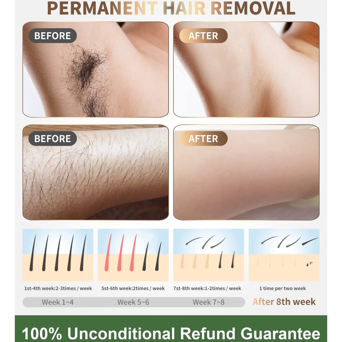 IPL Laser Hair Removal Device Permanent Painless Remover Reduction in Hair Regrowth for Women and Man at Home Whole Body Armpits Back Legs Arms Face Bikini Line, Corded - Medaid International