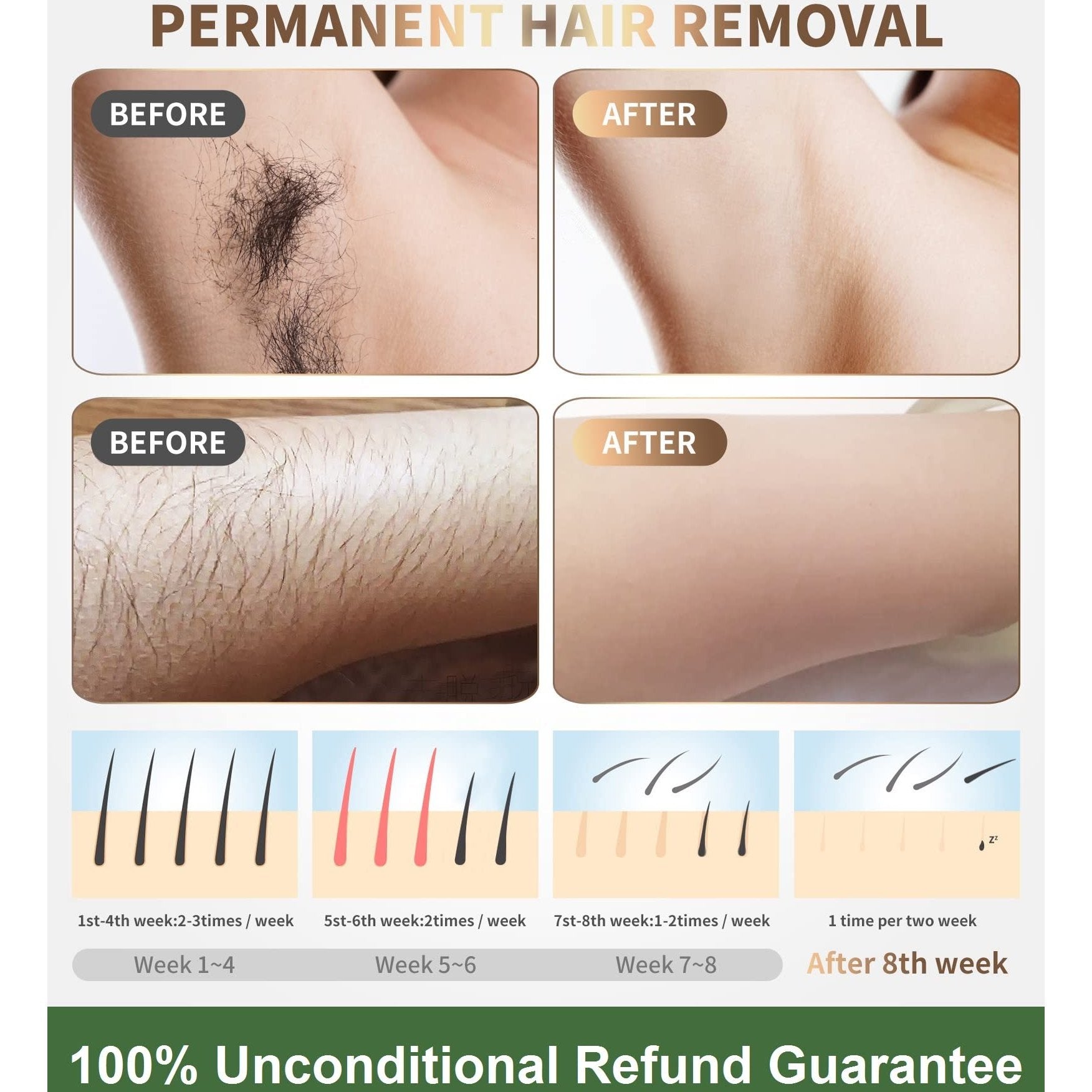 IPL Laser Hair Removal Device Permanent Painless Remover Reduction in Hair Regrowth for Women and Man at Home Whole Body Armpits Back Legs Arms Face Bikini Line, Corded - Medaid International