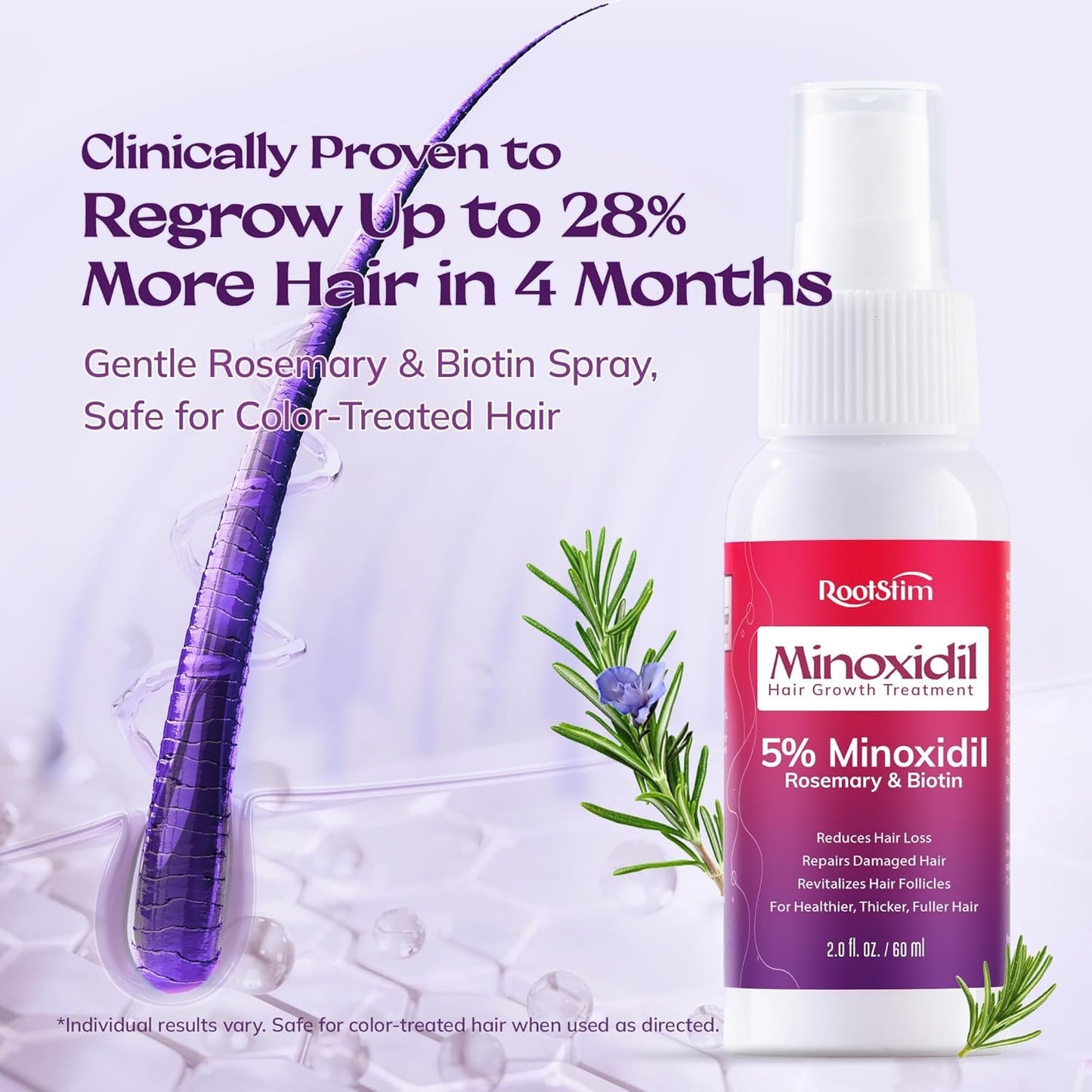 Women's 5% Minoxidil Spray for Hair Growth: RootStim - Medaid International