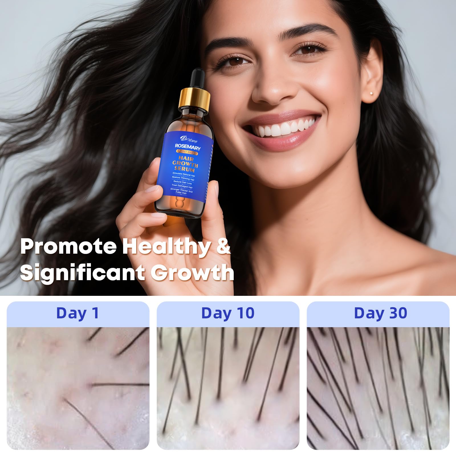 Hair Growth Serum with Rosemary Oil & Saw Palmetto - 100% Natural Plant-Based Formula to Stimulate Follicles, Revive Roots for Visibly Thicker Fuller Hair, Reduce Shedding and Loss For Men & Women - Medaid International