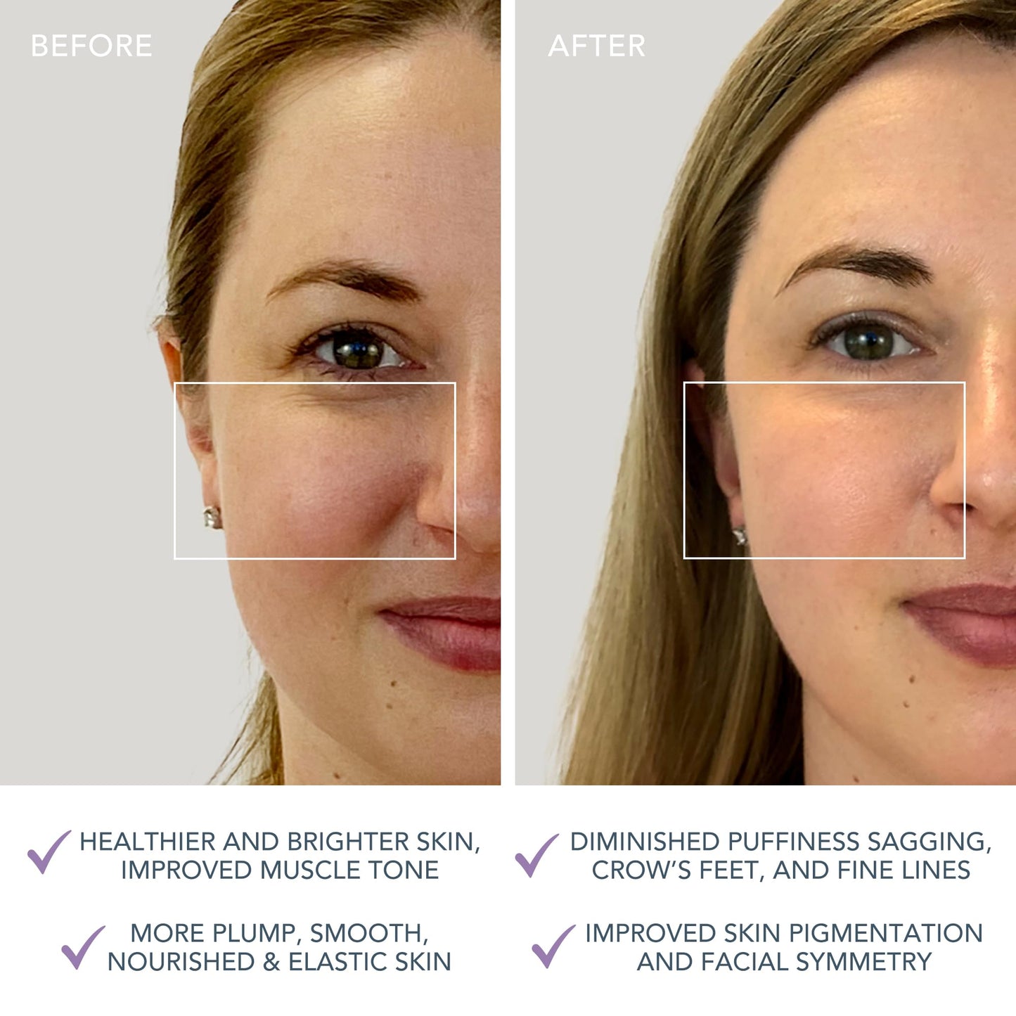 FOREO BEAR mini App-connected Microcurrent Facial Toning Device with 3 Intensities, Lavender - Medaid International