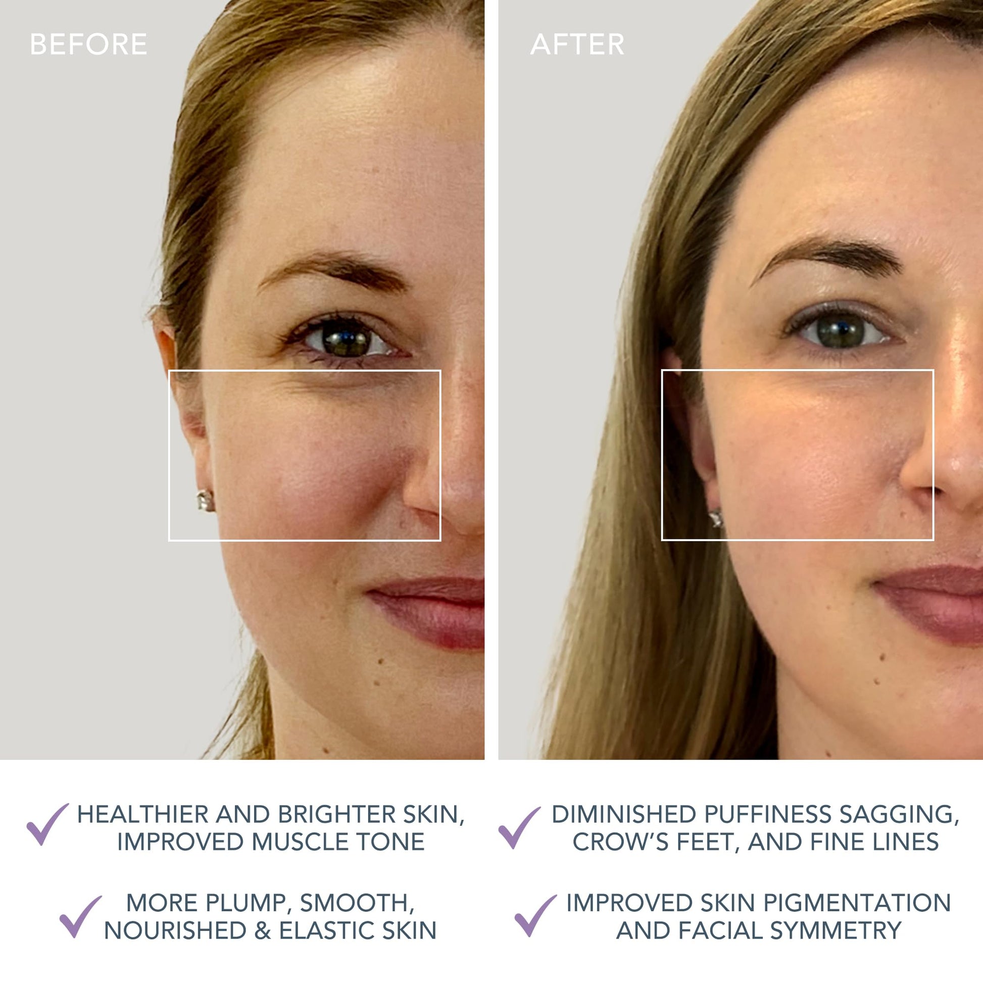 FOREO BEAR mini App-connected Microcurrent Facial Toning Device with 3 Intensities, Lavender - Medaid International