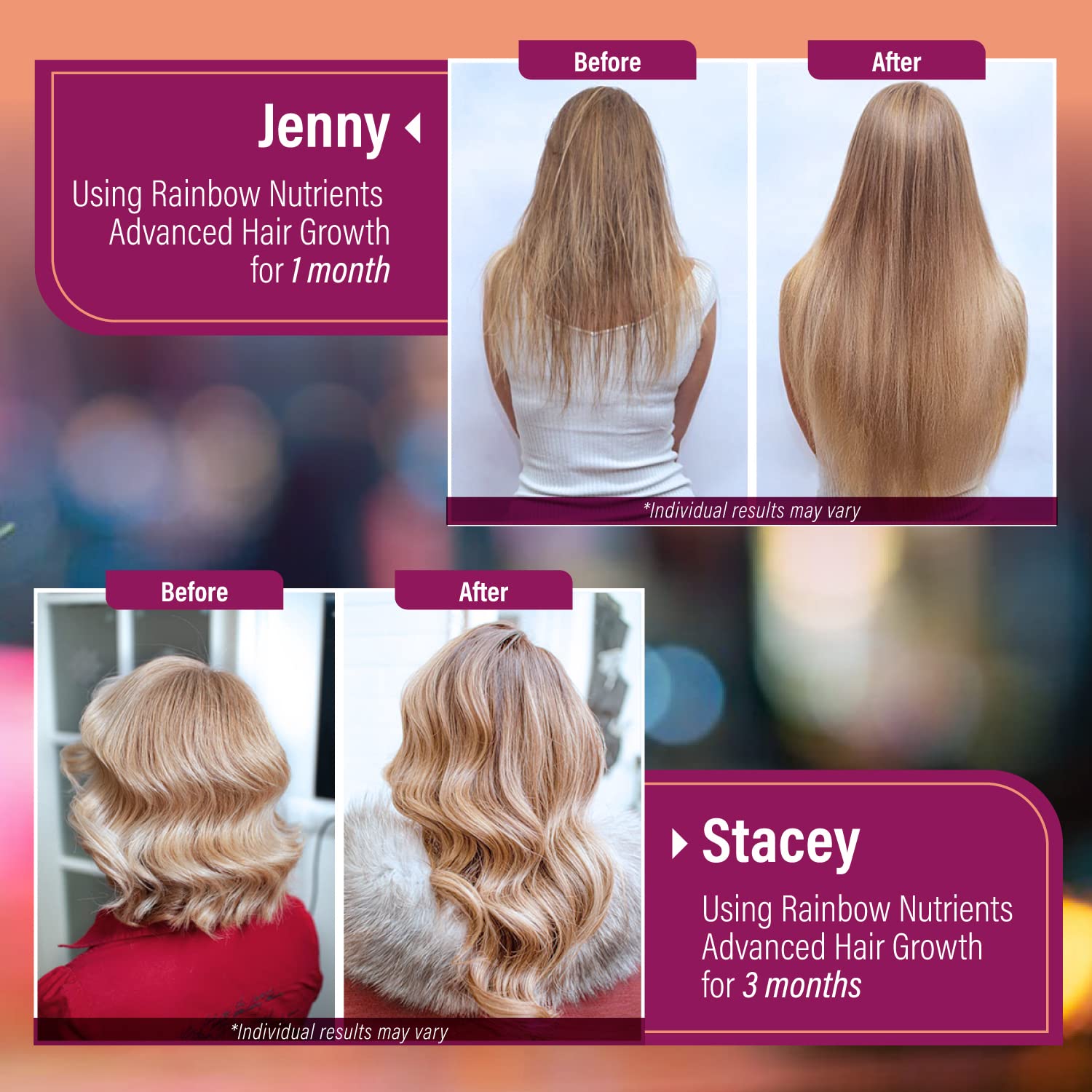 Hair Growth Vitamins for Women | Biotin 10,000mcg, Collagen, Patented OptiMSM®, goMCT®, Saw Palmetto | Naturally Regrow Stronger & Healthier Hair, Skin and Nails | Stops Hair Loss | 60 Day Supply - Medaid International