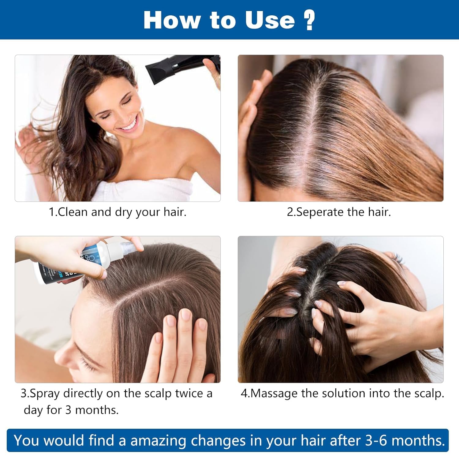 5% Minoxidil for Men Women, 100ML Minoxidil Hair Growth, Hair Regrowth Treatment Spray, Minoxidil Topical Solution Hair Growth Serum Stop Thinning and Loss Hair 2 Month Supply, for Beard, Hair - Medaid International