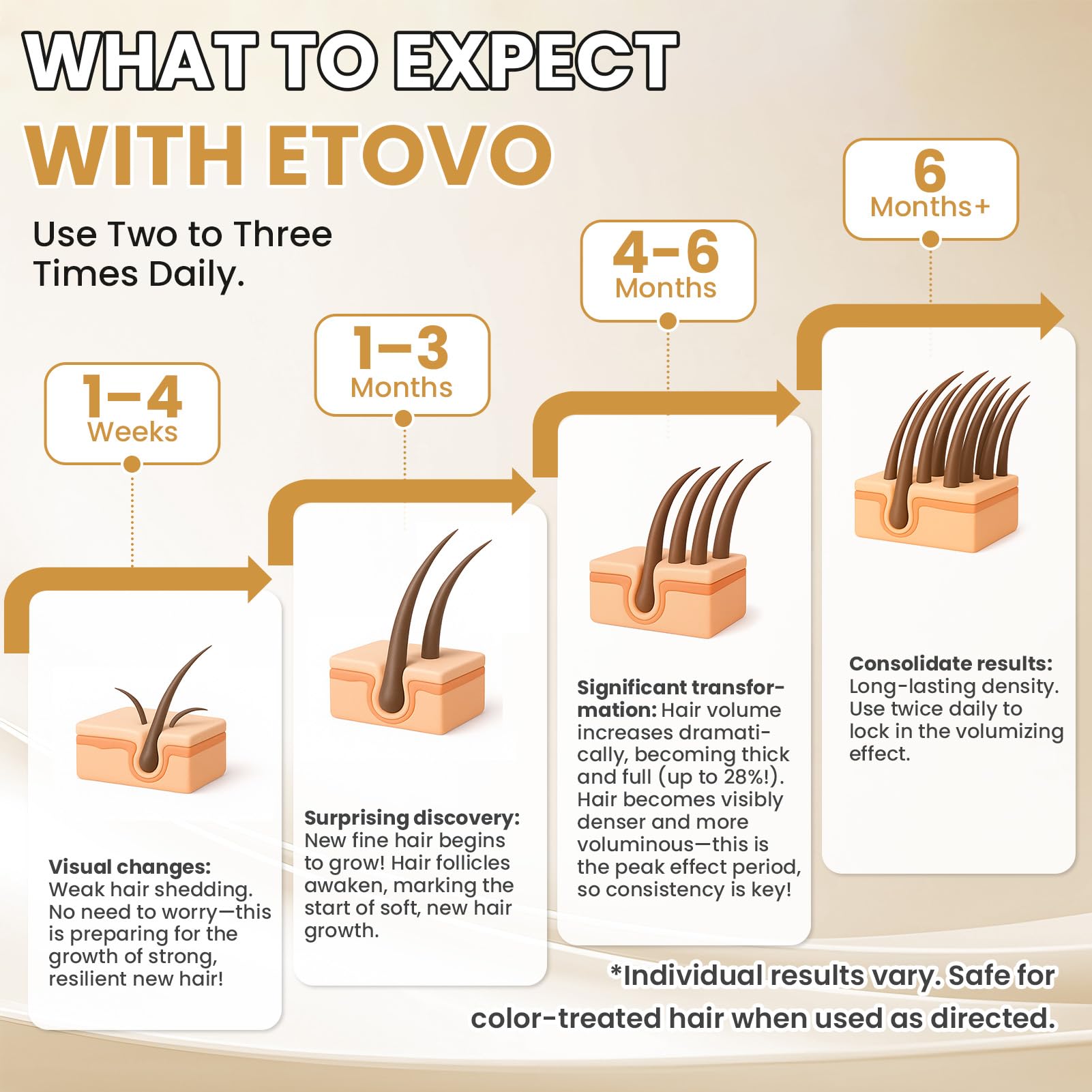 5% Minoxidil for Women Hair Growth Serum Topical Minoxidil Hair Regrowth Thicker Prevent Hair Loss for Thickening Longer Fuller - Medaid International