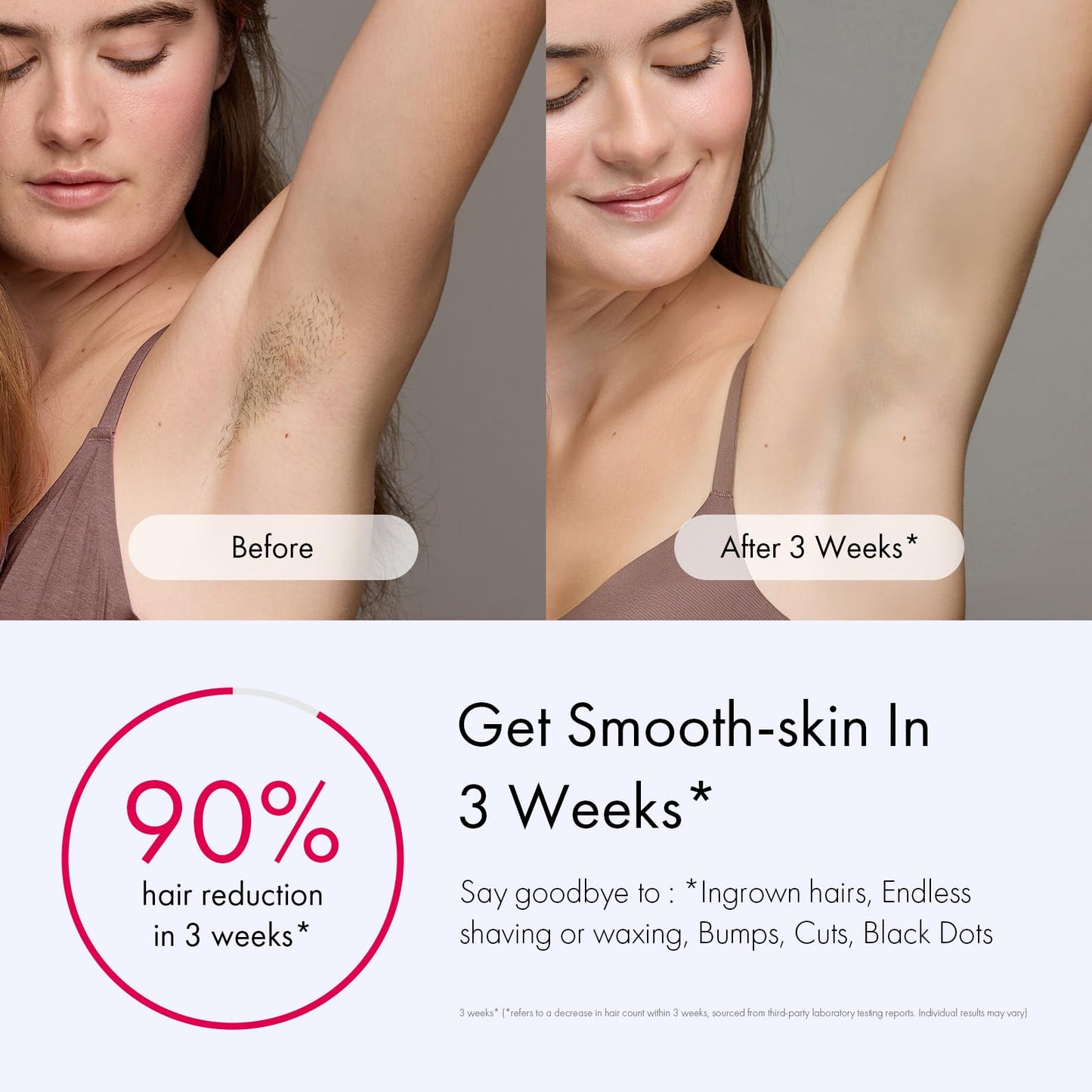 Ulike Laser Hair Removal for Women and Men, Air 3 Ice-Cooling IPL Hair Removal Device for Nearly Painless & Long-Lasting Results, 3 Modes & Auto Flashing for Fast Full Body Hair Removal from Home - Medaid International