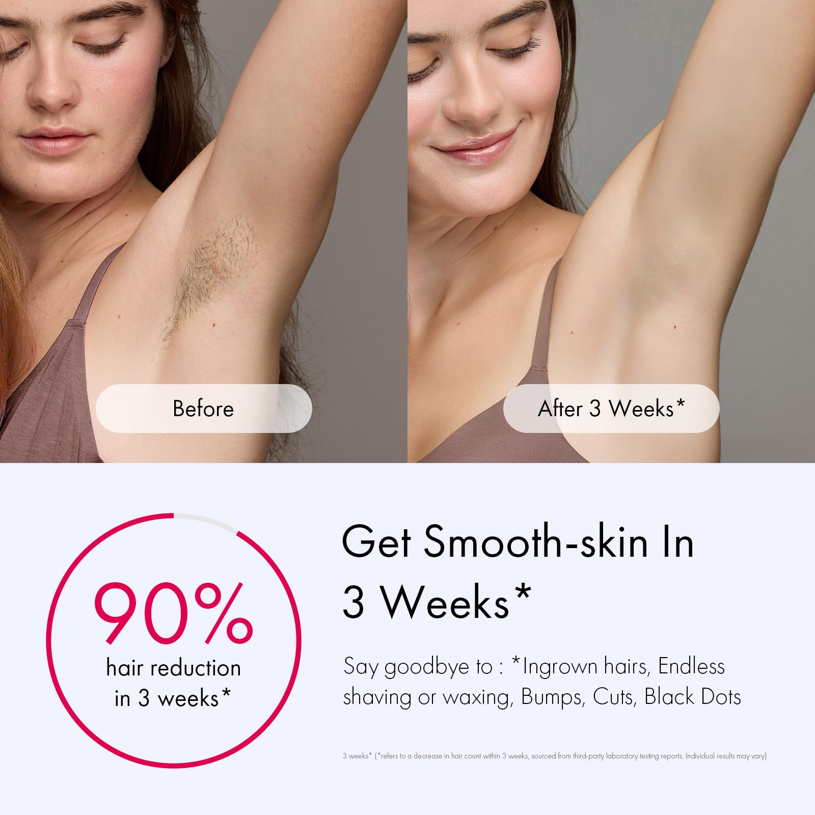 Ulike Laser Hair Removal for Women and Men, Air 3 Ice-Cooling IPL Hair Removal Device for Nearly Painless & Long-Lasting Results, 3 Modes & Auto Flashing for Fast Full Body Hair Removal from Home - Medaid International