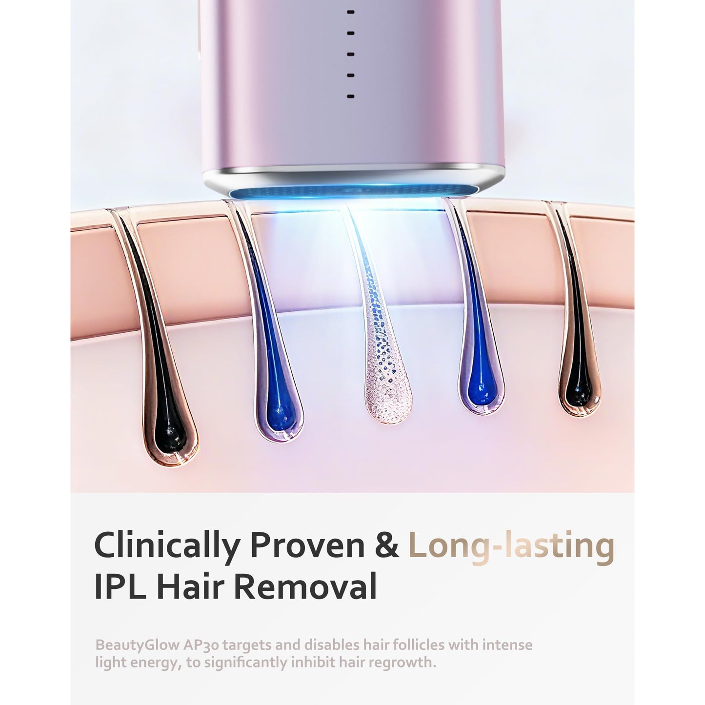 BeautyGlow Laser Hair Removal Device for Women & Men, At Home IPL Hair Remover with Ice Cooling Technology for Face & Body, Painless & Long-Lasting Results - Medaid International