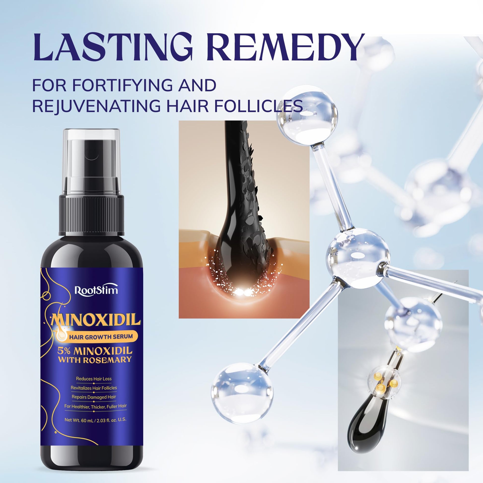 5% Minoxidil Hair Growth for Men and Women: Extra Strength Minoxidil Hair Loss Treatment Serum with Rosemary for Faster Stronger Thicker Hair Growth 60ML - Medaid International