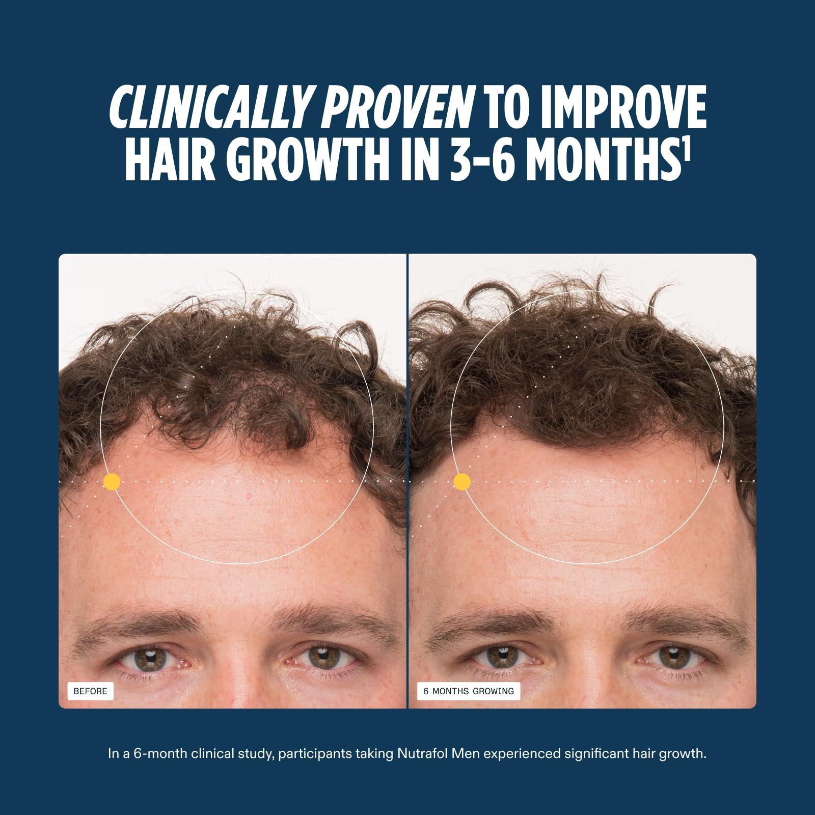 Nutrafol Men's Hair Growth Supplements, Clinically Tested for Visibly Thicker Hair and Scalp Coverage, Dermatologist Recommended - 1 Month Supply - Medaid International