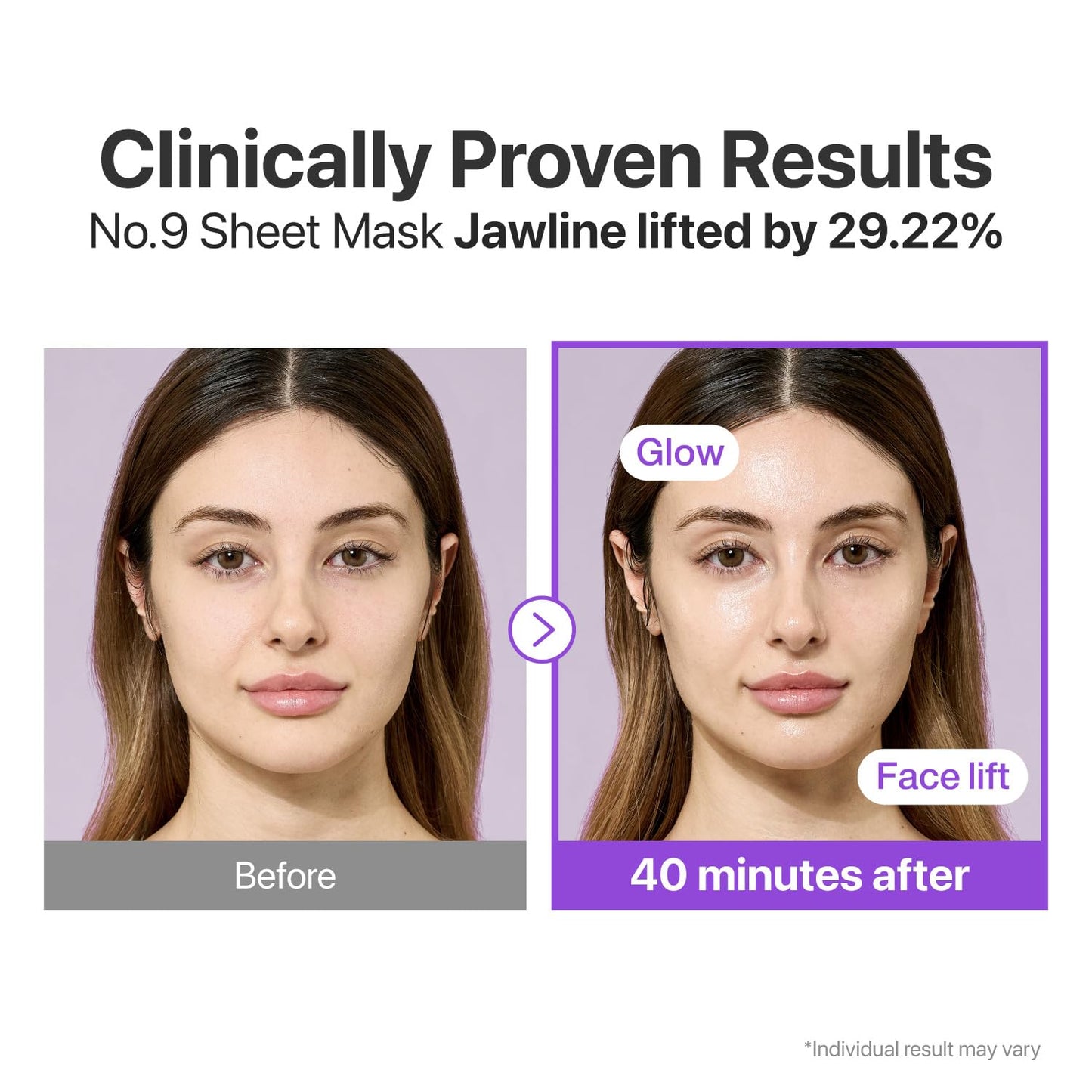 numbuzin No.9 Sheet Mask | NAD+ BIO Lifting-sil Full Face Mask | Improves Jawline, Jowls, Wrinkles, Neck Lines | Peptides, NAD+, Collagen | Skin Firmness | 4 Sheets + Lifting Band - Medaid International