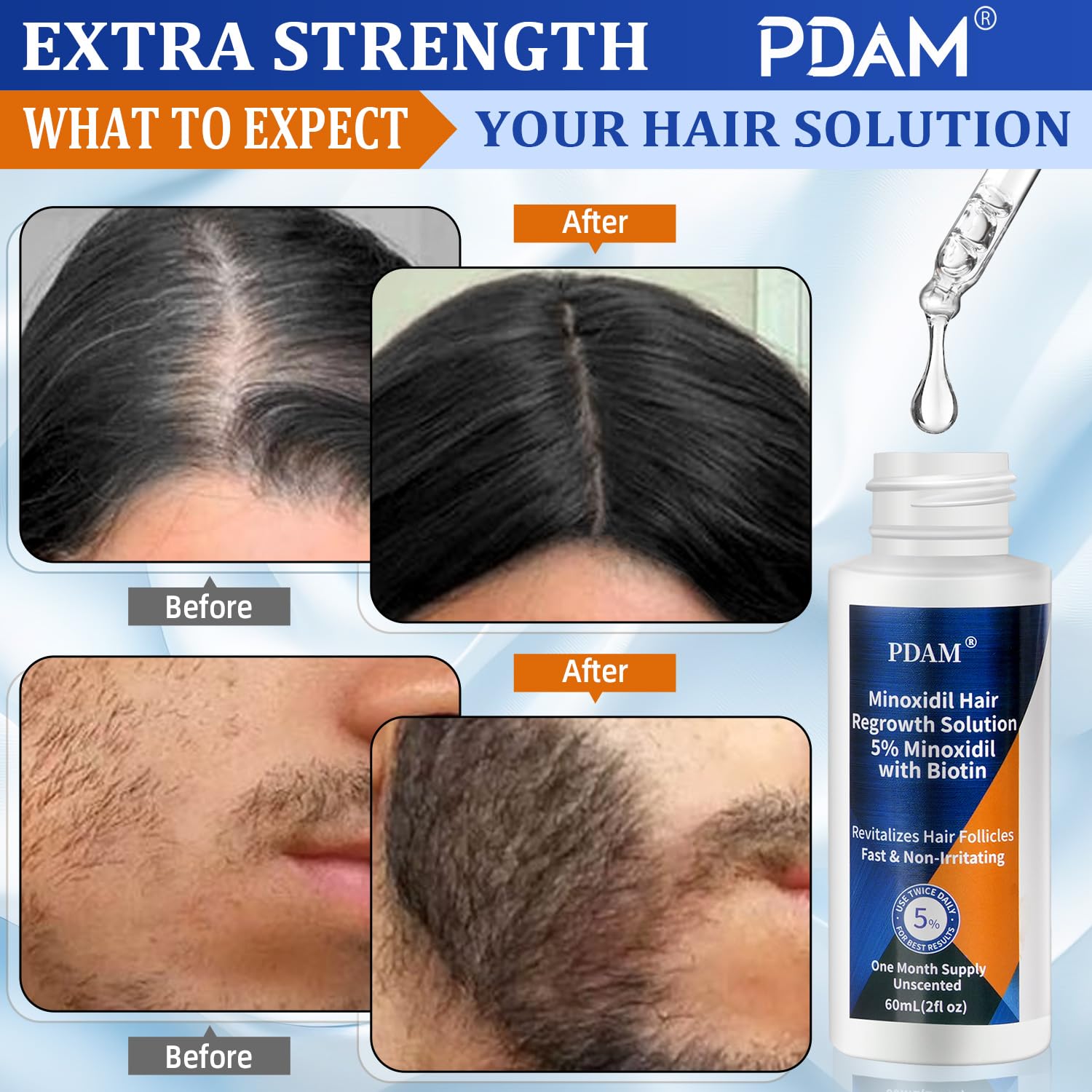 Minoxidil for Men and Women Hair Growth - 5% Minoxidil Hair Growth Serum for Men to Regrow Fuller, Thicker Hair & Beard - Minoxidil for Women Hair Growth- Improves Appearance of Thinning Hair 2 FL OZ - Medaid International