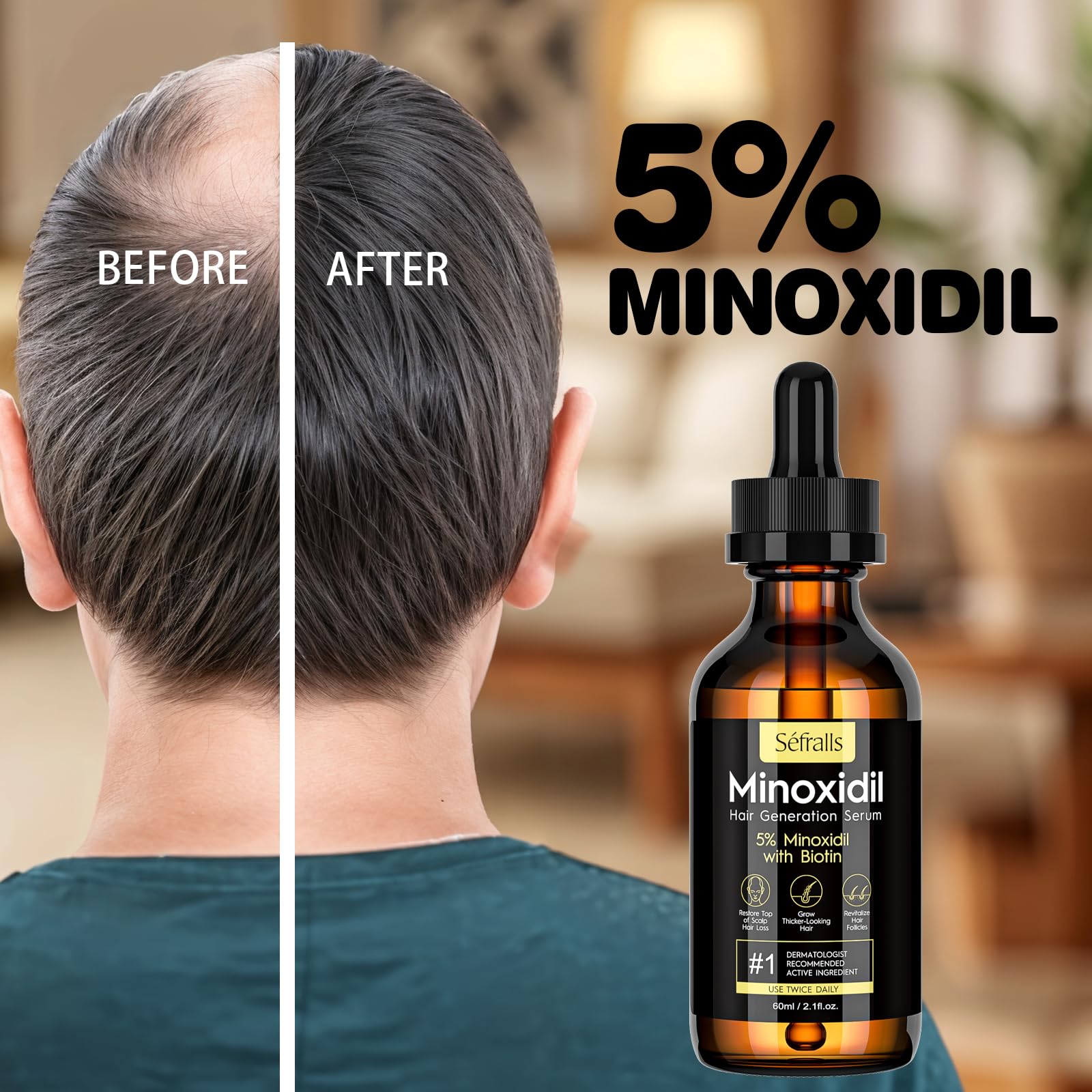 5% Minoxidil Hair Growth Serum Oil For Men and Women, Biotin Hair Serum, Safest Hair Regrowth Treatment, Prevent Scalp Hair Loss 60ml / 2.11 fl.oz - Medaid International