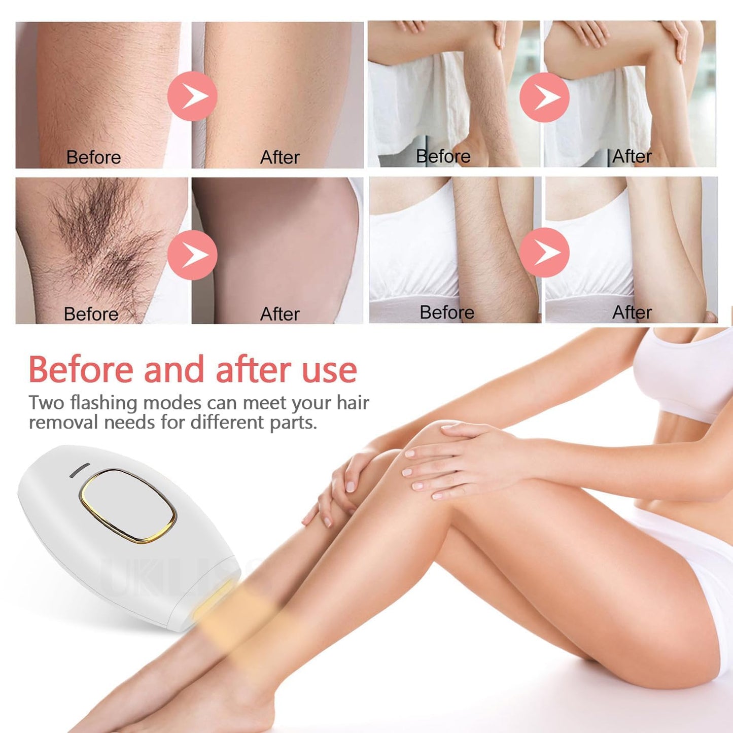 Hair Removal Device for Women and Men, IPL Laser Hair Removal Device with 5 Energy Levels, for Face, Arms, Legs, Bikini Line, Underarms, and Body - Medaid International