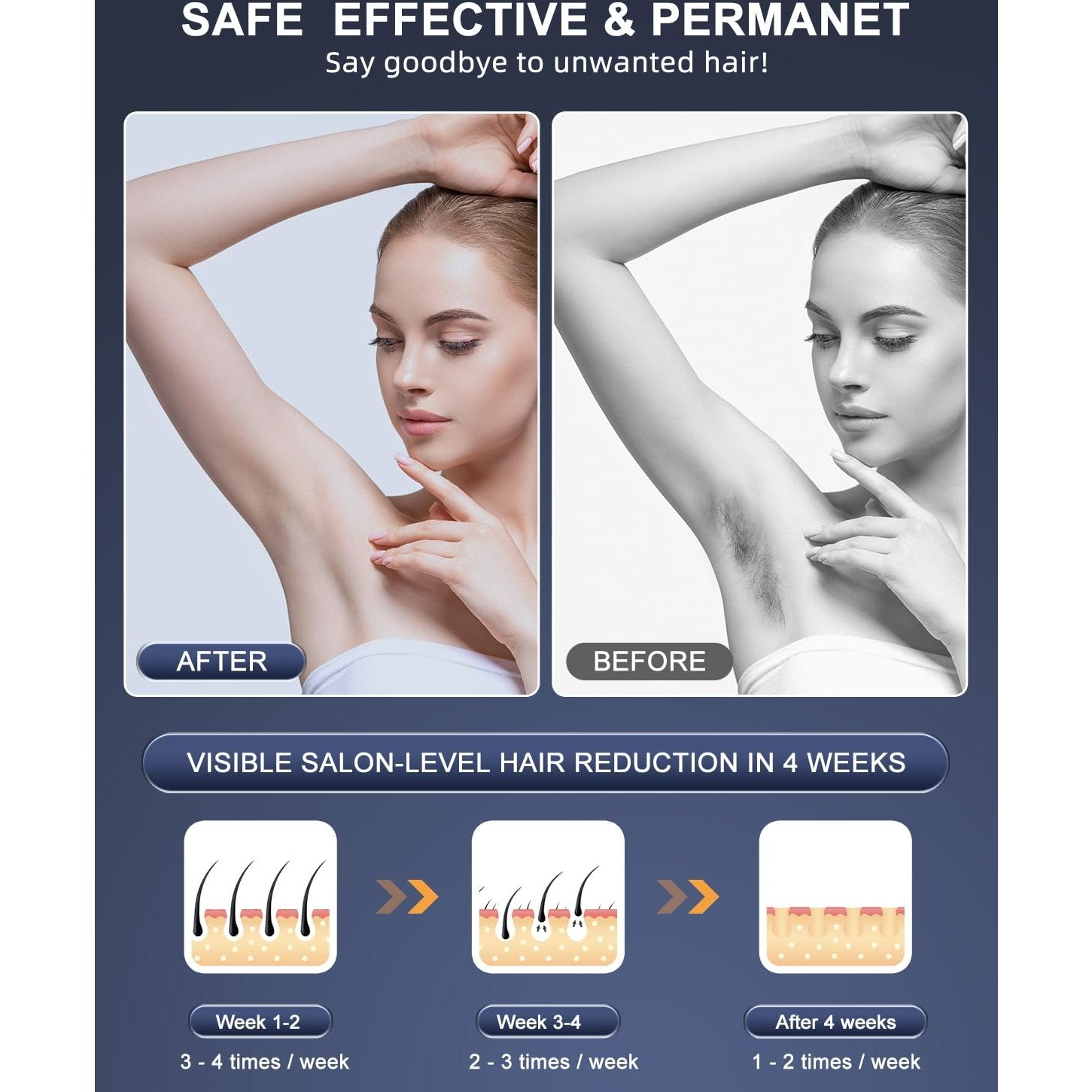 Laser Hair Removal, IPL Hair Removal Permanent for Women and Men, Hair Removal Device 999999 Flashes at-Home for Facial Legs Arms Whole Body Treatment - Medaid International