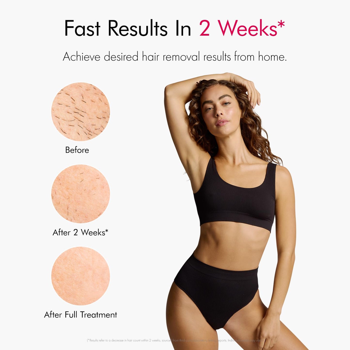 Ulike Laser Hair Removal Air 10 IPL Holiday Gift for Women and Men, 65°F Ice-Cooling Contact, Dual Lights, Skin Sensor & USHR Mode* for Nearly Painless, Effective & Long-Lasting Hair Removal from Home - Medaid International