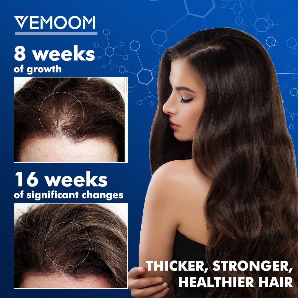 5% Minoxidil Hair Growth Spray for Women and Men, Effective Anti-Hair Loss Treatment for Regrowth, Extra Strength Scalp Solution, Thicker, Stronger and Longer Hair - 60ml*2 - Medaid International