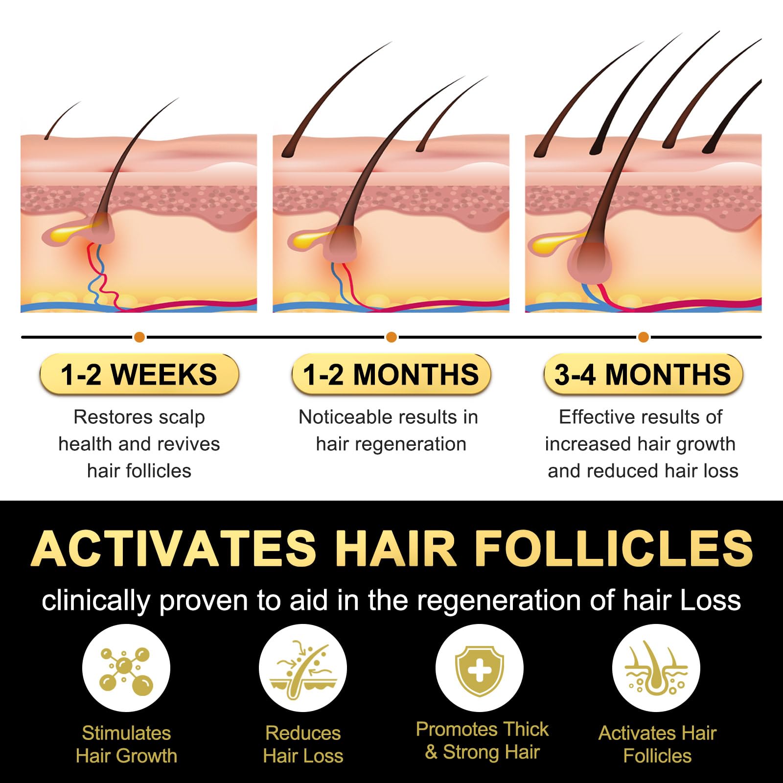 5% Minoxidil for Men and Women Hair Growth Serum, Biotin Hair Growth, Hair Regrowth Treatment for Scalp Hair Loss Hair Thinning for Thicker Longer Fuller Healthier Hair (Pack of 1) - Medaid International