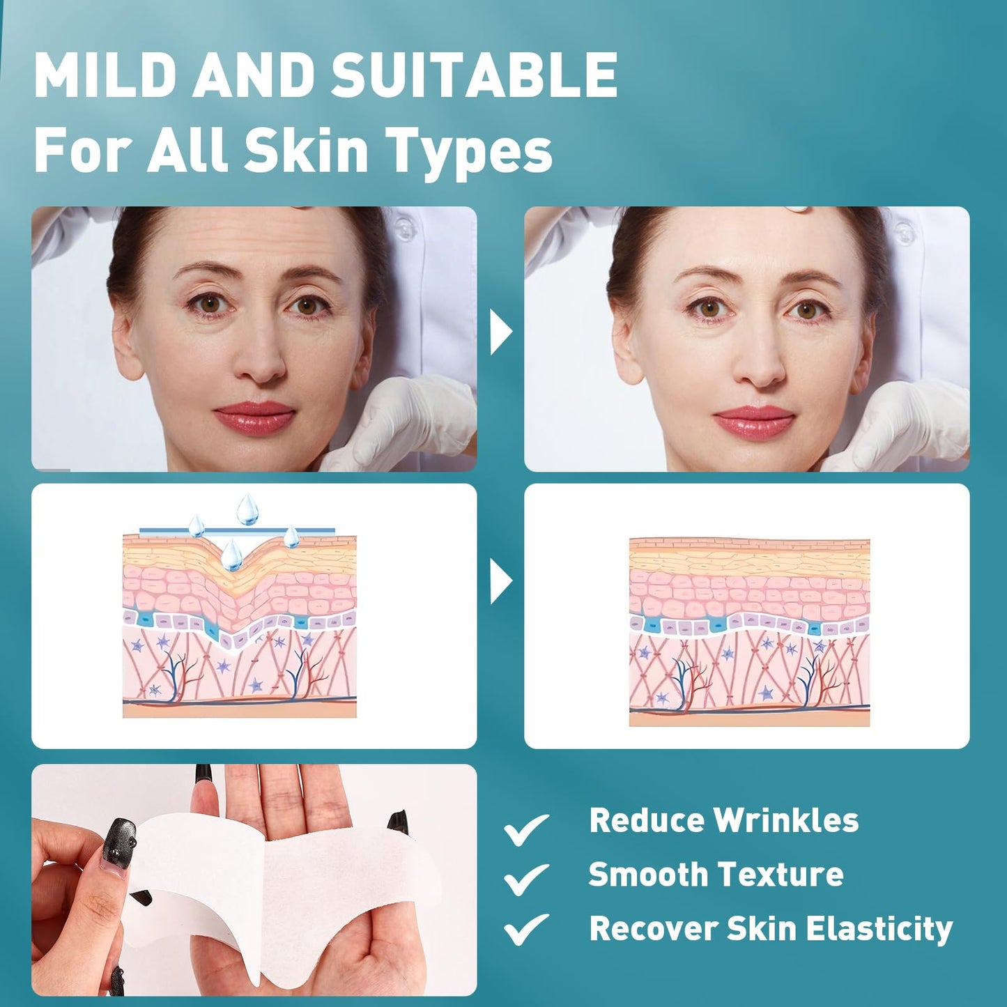 YHOVID 28 Pcs Forehead Wrinkle Patches - Anti Wrinkle Facial Patches with Collagen and Vitamin E for Face Overnight to Smoothing Fine Frown Lines & Wrinkles Treatment - Medaid International