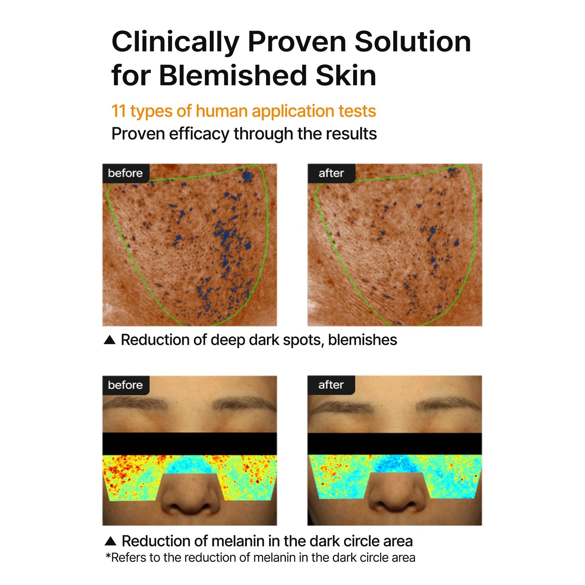 celimax Pore+Dark Spot Brightening Cream | with Niacinamide, Tranexamic Acid, TXA Cream, Pore Minimizer, Non-Irritating, Hydrating, For Sensitive Skin, 35ml - Medaid International