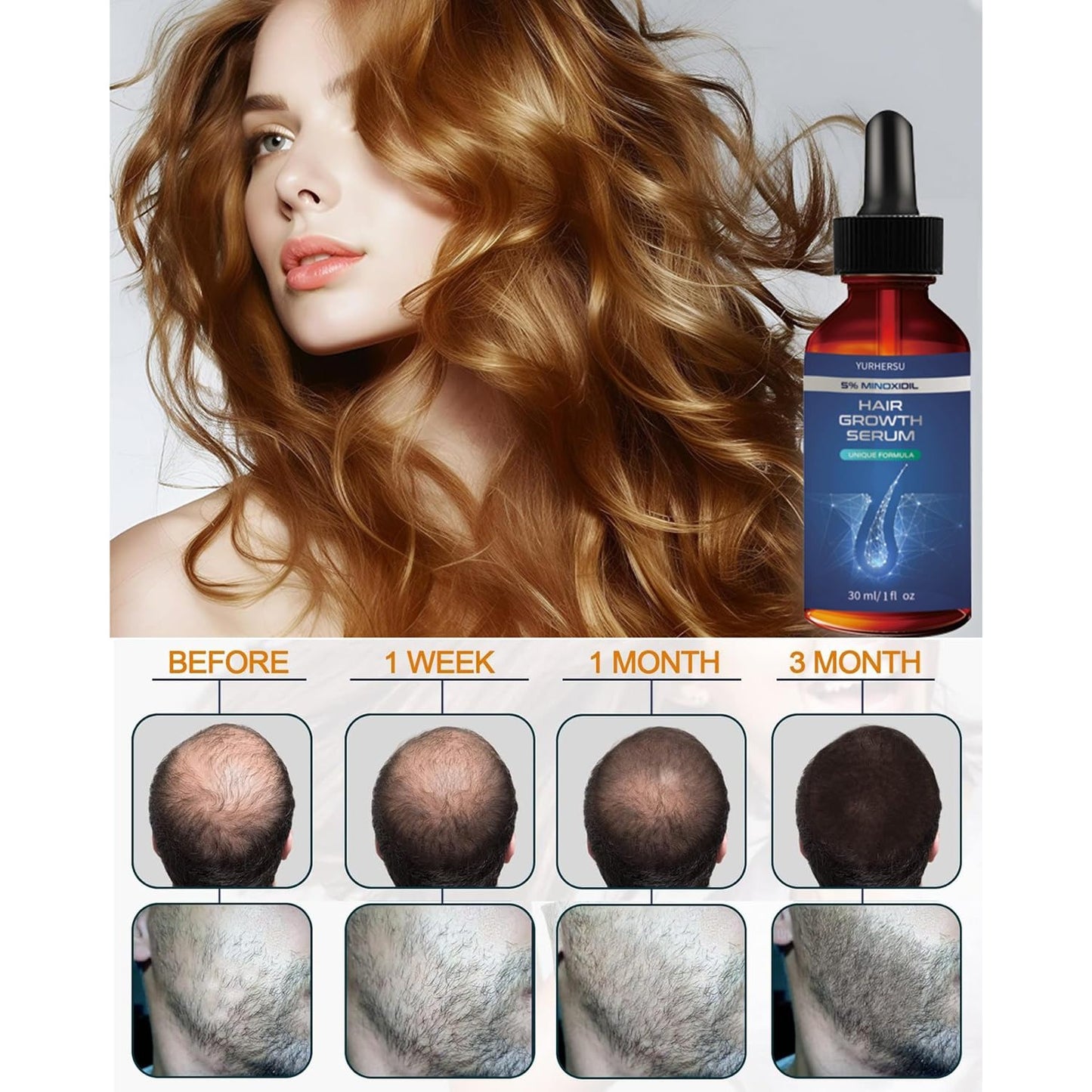 Hair Growth Serum, 5% Minoxidil, With Biotin & Glycerin, for Men's Beard & Women's Hair Regrowth, Anti Hair Loss Treatment, Make Hair Stronger Thicker Longer, 1 fl oz (30 ml) - Medaid International