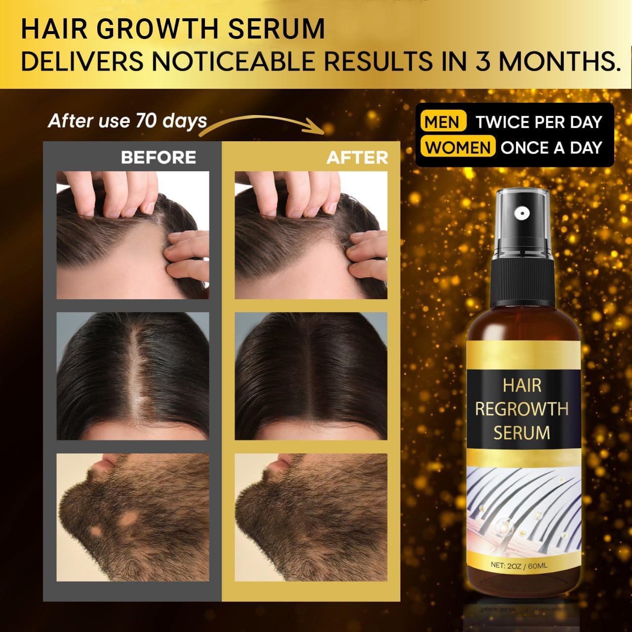 Hair Growth Oil Spray: Hair Regrowth Serum with Rosemary Biotin Ginseng for Hair Loss and Thinning-Thicker Fuller Longer - for Women and Men - Medaid International