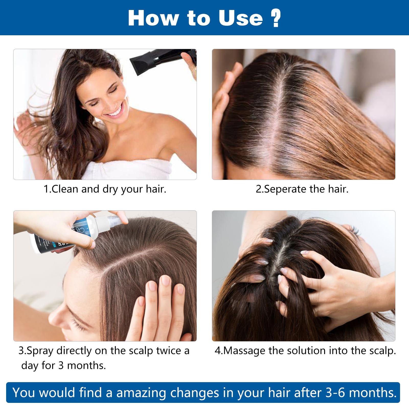 5% Minoxidil Hair Growth Serum for Men and Women - Hair Regrowth Treatment Spray, Topical Solution to Stop Thinning and Hair Loss, 2 Month Supply for Beard and Hair Growth, 100ML - Medaid International