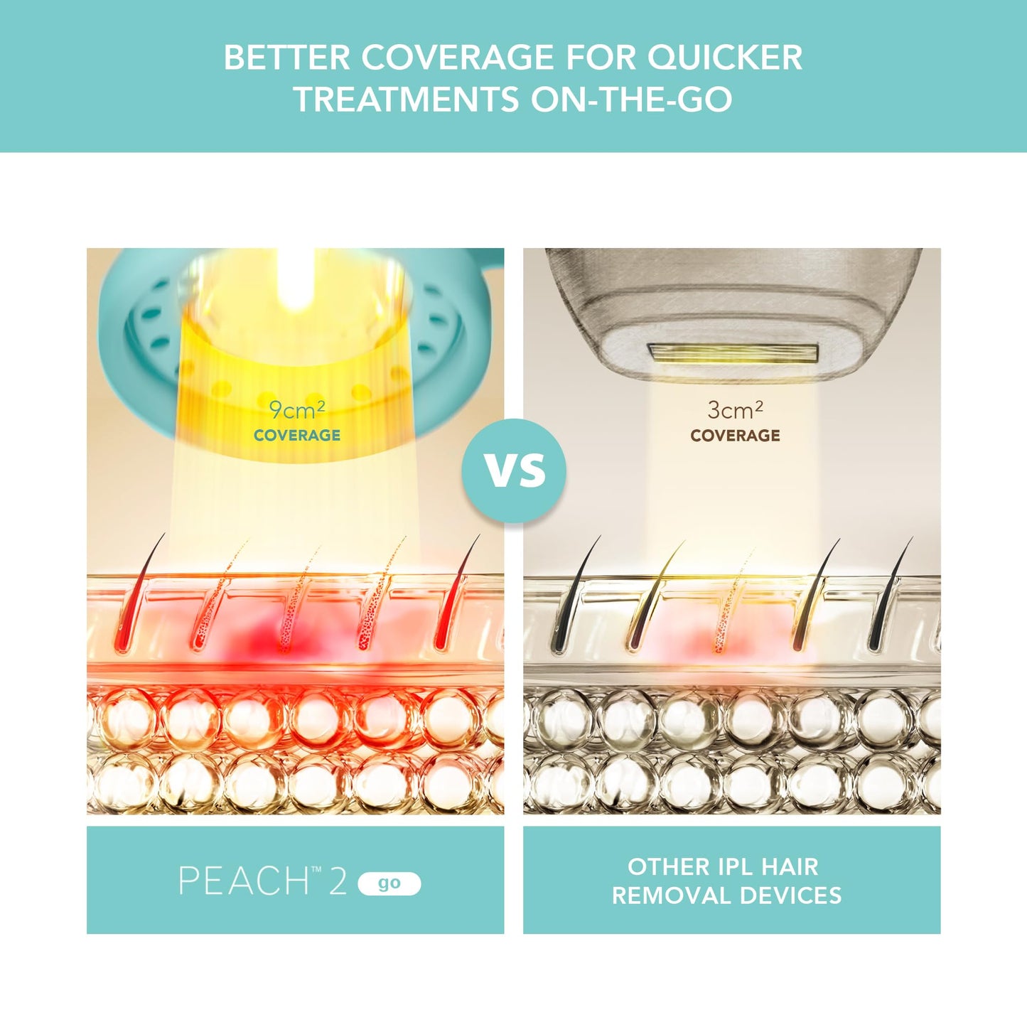 FOREO Peach 2 go IPL Hair Removal Device - Travel-Friendly Permanent Hair Removal - Laser Hair Removal - Body & Face - Painless Hair Removal - Skin Cooling & Silicone Shield - Customizable Artic Blue - Medaid International